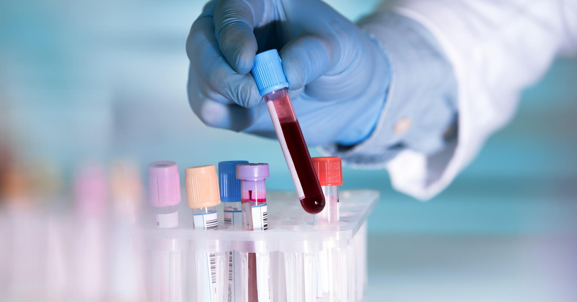 Substytut krwi – zastosowanie nie tylko w transplantologii