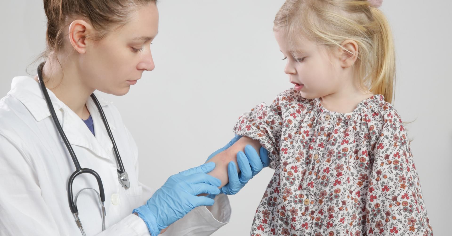 Refundacja leczenia biologicznego dla najmłodszych dzieci z ciężkim AZS od 2025 roku