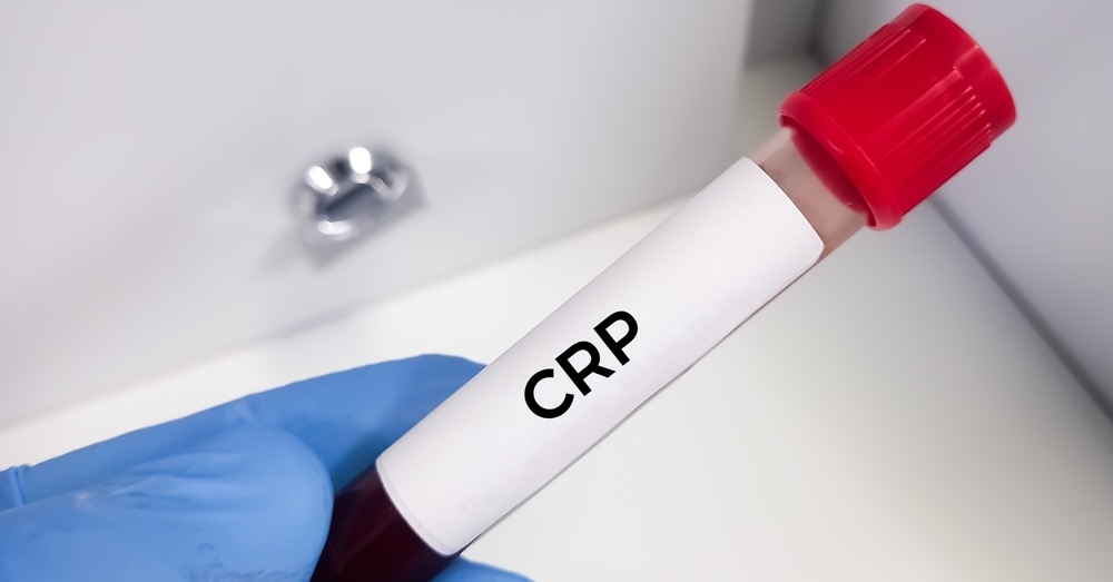 CRP – przydatny marker zapalenia czy źródło diagnostycznych pułapek?