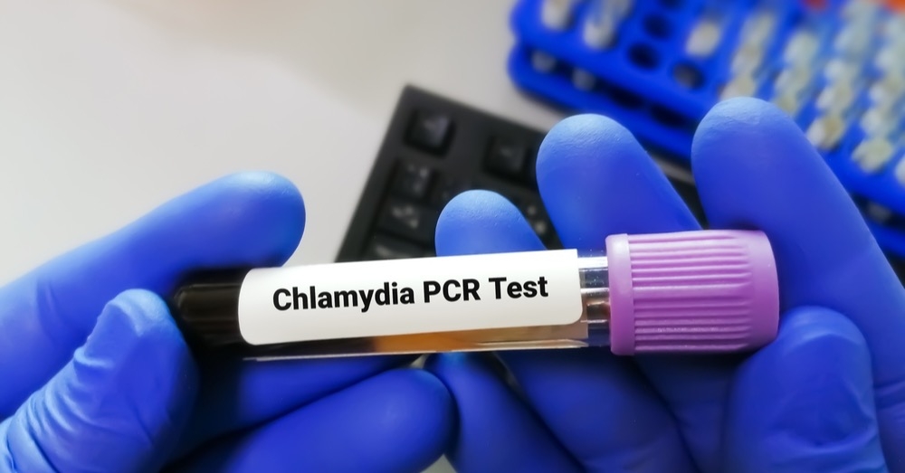 Choroby przenoszone drogą płciową – nadal aktualne wyzwanie diagnostyczno-terapeutyczne