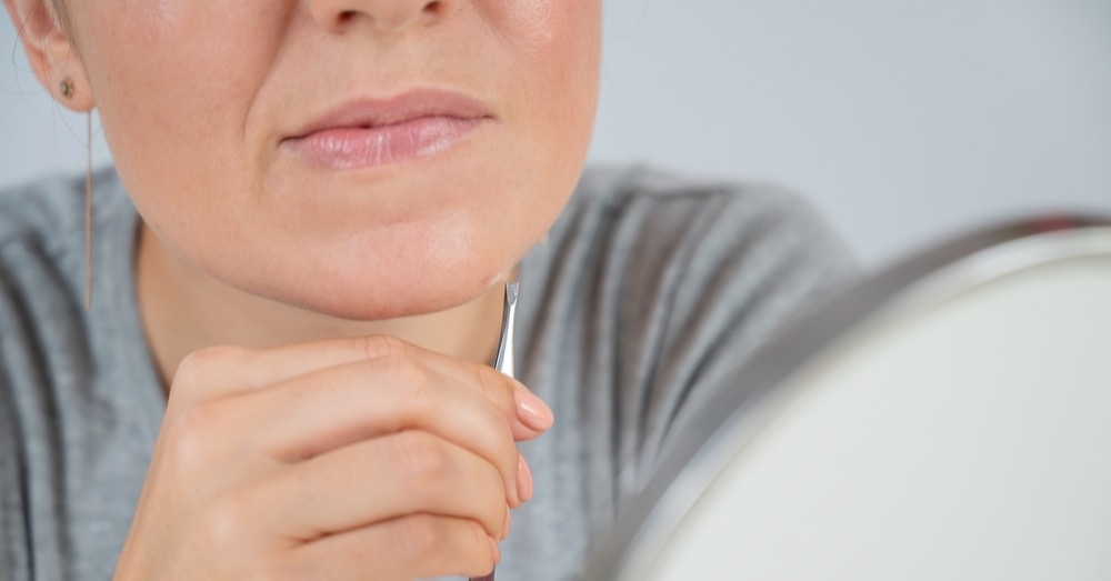 Hirsutyzm – jak rozpocząć diagnostykę u młodej pacjentki?