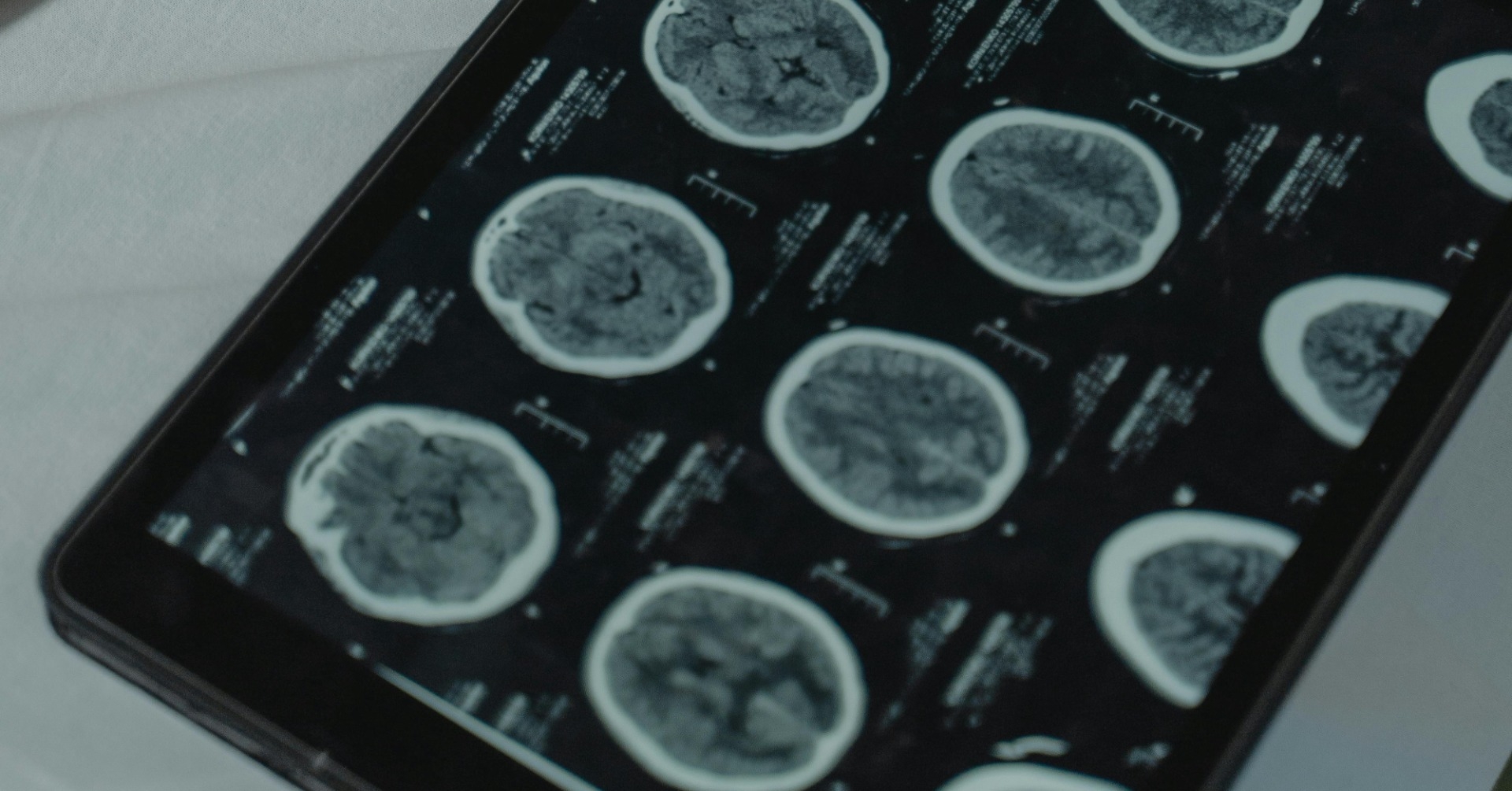 Czy neurolodzy korzystają z AI?