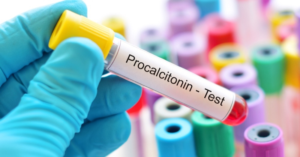 Prokalcytonina – “lepsza siostra” CRP?