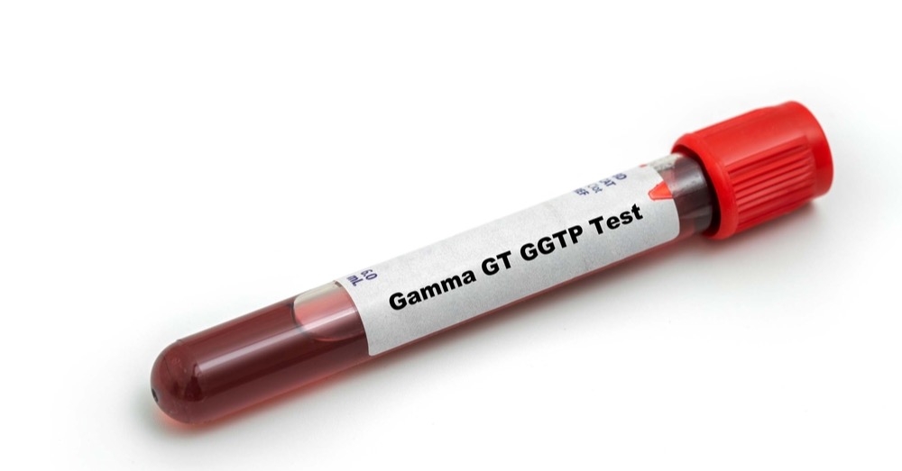Co może oznaczać wzrost aktywności GGTP?