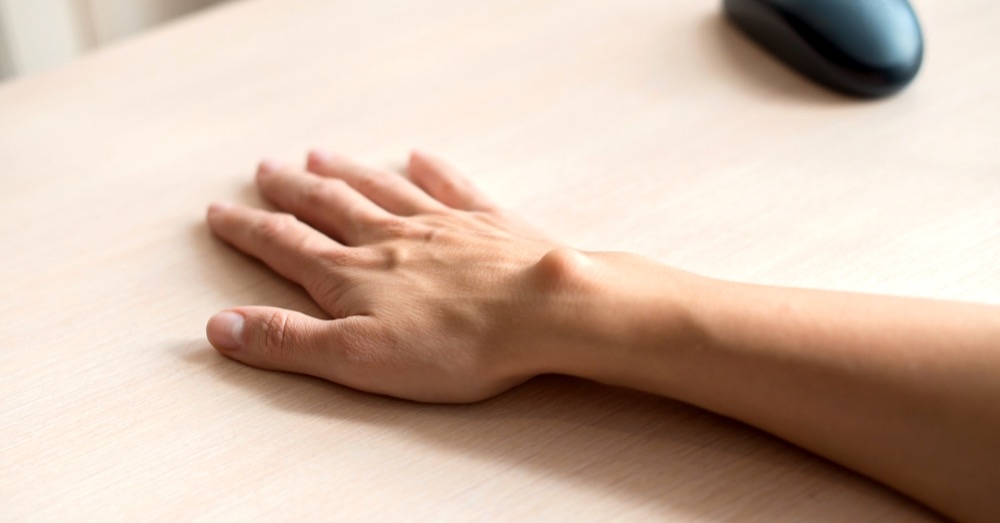 Ganglion nadgarstka