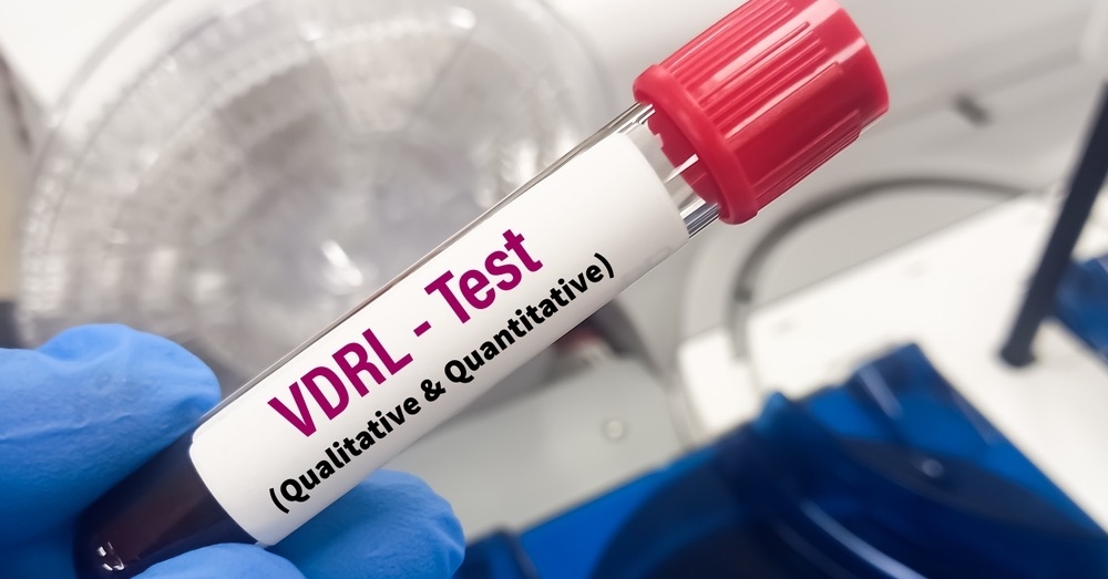 VDRL i FTA-ABS – co trzeba wiedzieć o diagnostyce kiły?