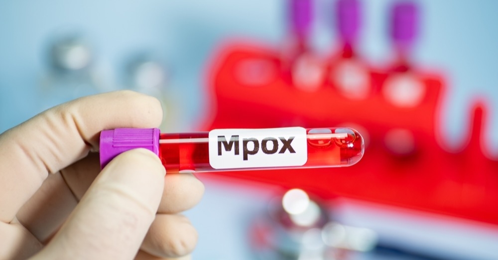 Małpia ospa – u kogo podejrzewać mpox i jakie leczenie wdrożyć?