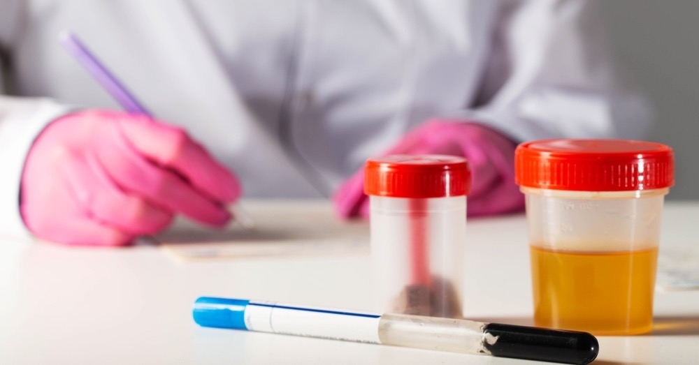 Kalprotektyna – czuły wskaźnik czy nadużywany test?
