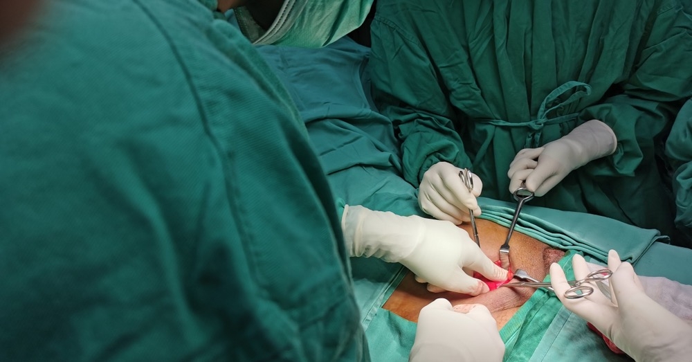 Przepuklina pachwinowa – kiedy można obserwować, a kiedy operować?