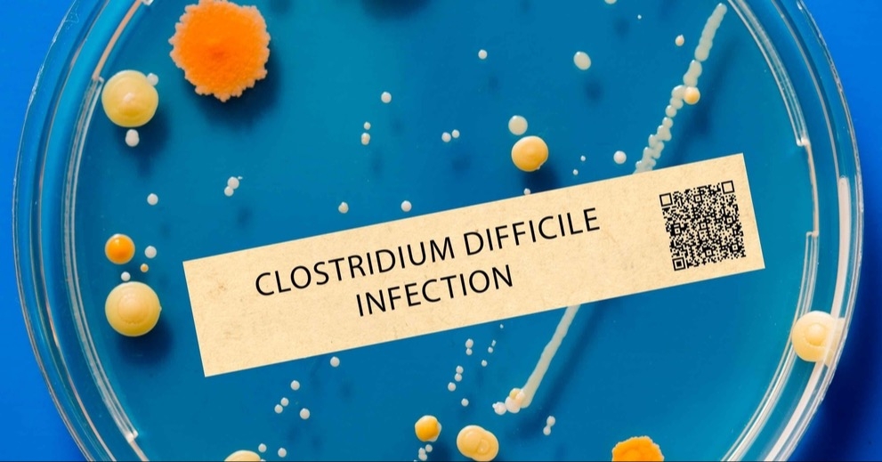 Clostridioides difficile