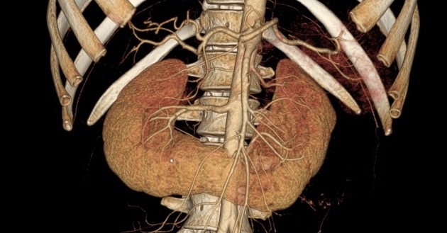 Nerka podkowiasta – przypadkowe znalezisko czy kliniczne wyzwanie?