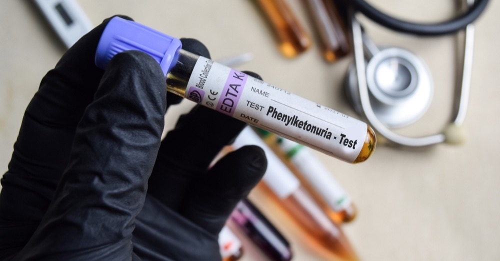 fenyloketonuria