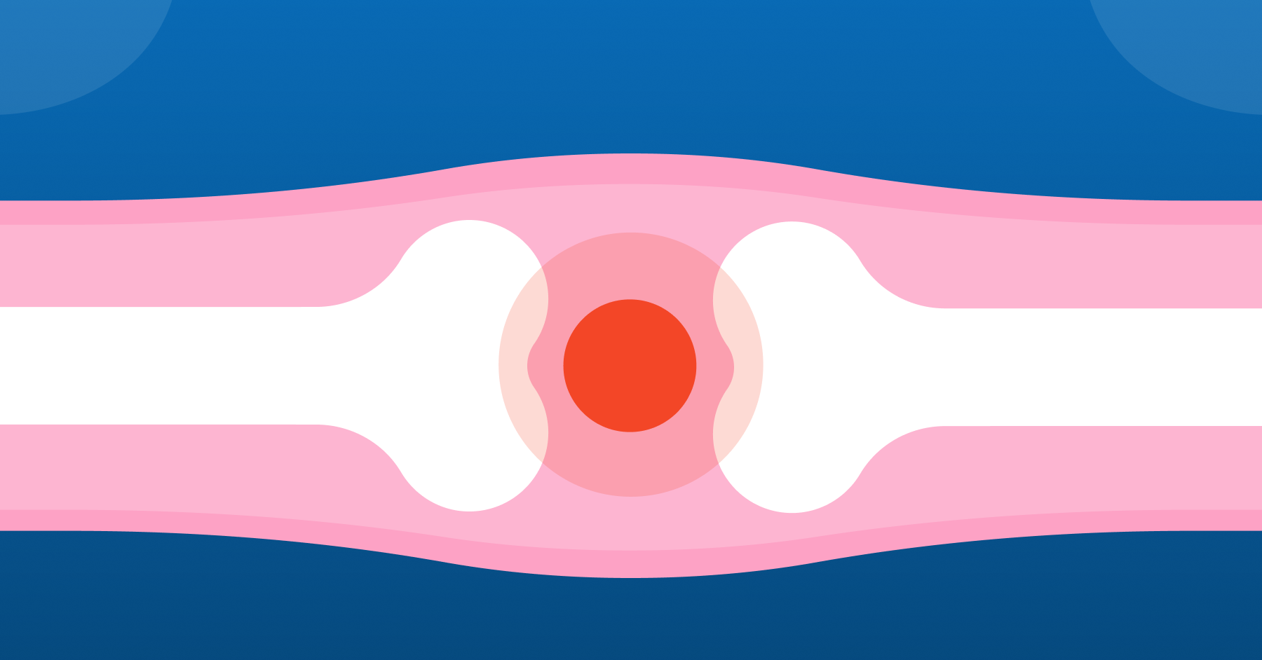 Diagnozuj i lecz: Choroba zwyrodnieniowa stawu kolanowego u osoby starszej