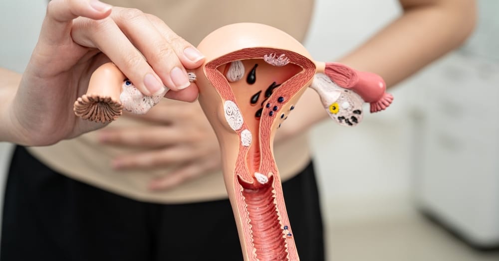 Niewydolność szyjki macicy – farmakoterapia czy szew?