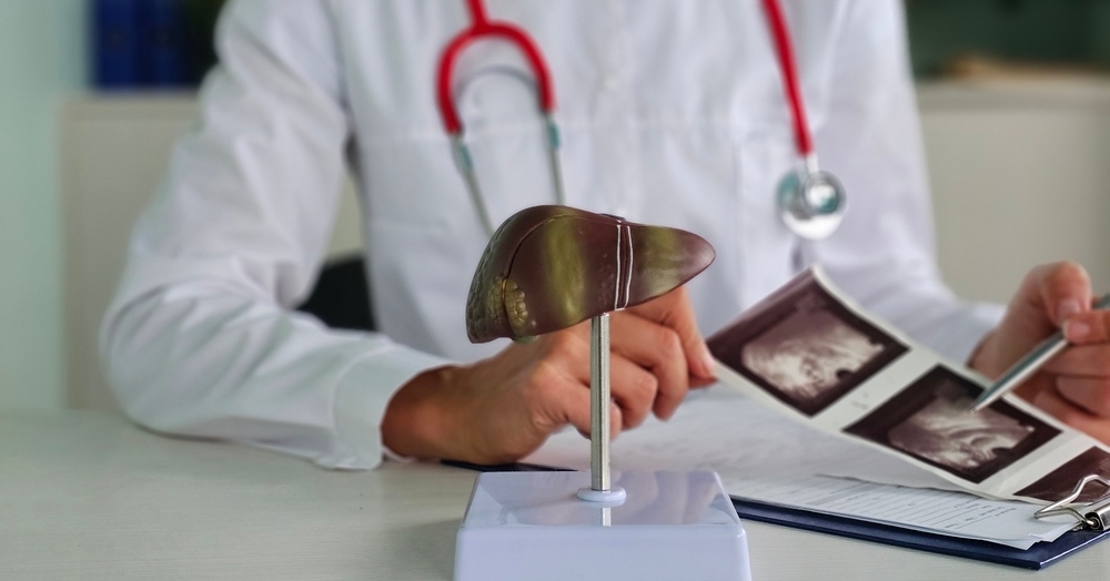 MASLD i MASH – nowa nomenklatura stłuszczenia wątroby