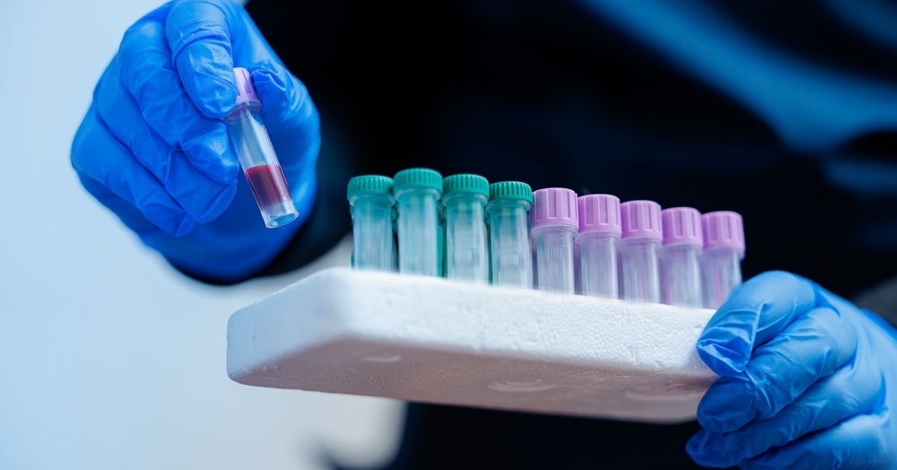 Leukocytoza i leukopenia – infekcja czy choroba hematologiczna?