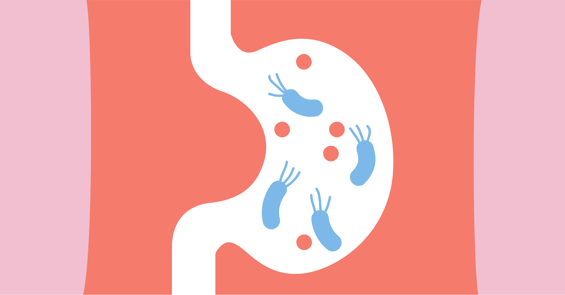 Diagnozuj i lecz: zakażenie  Helicobacter pylori u pacjentki z dyspepsją