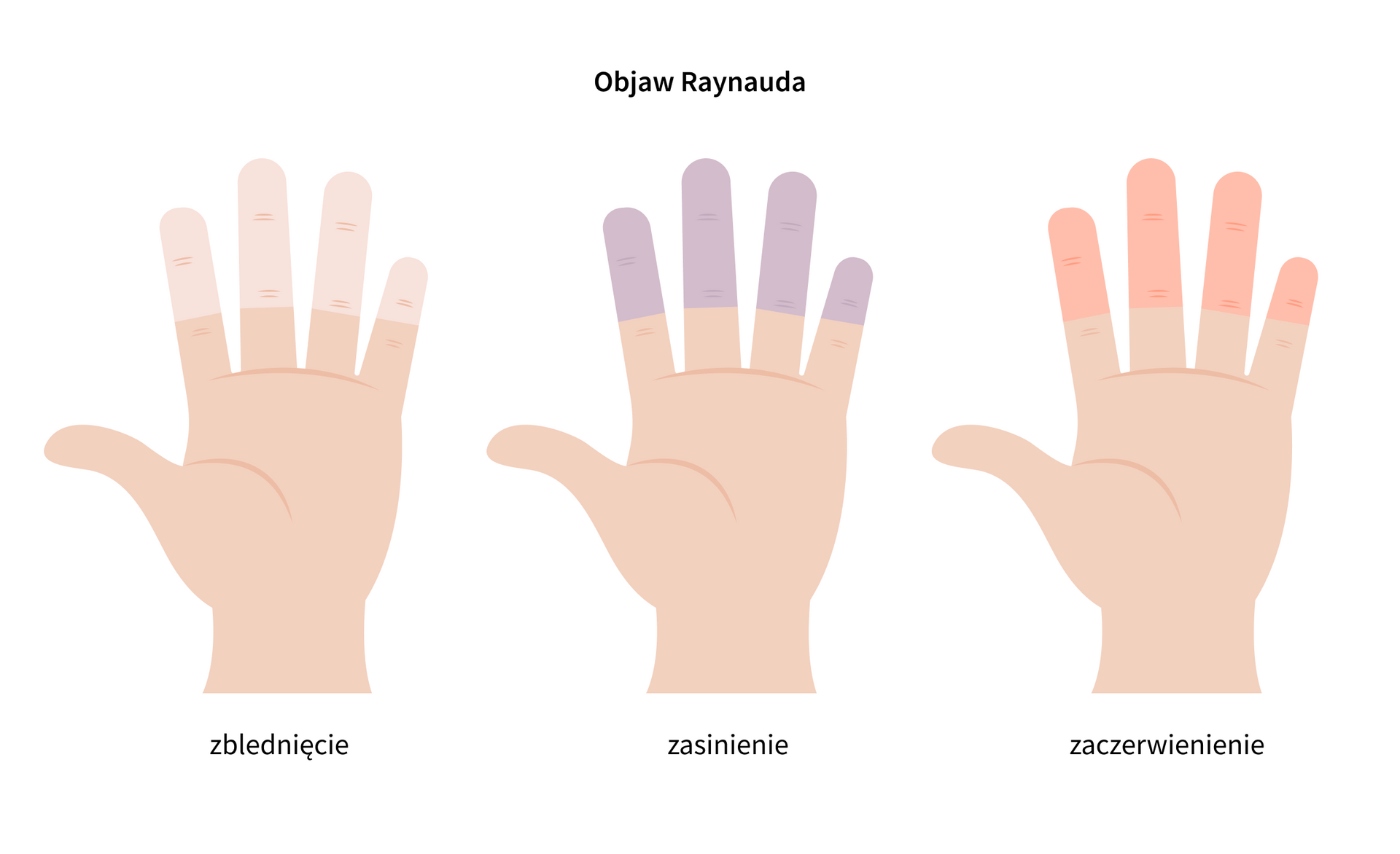 grafika 1