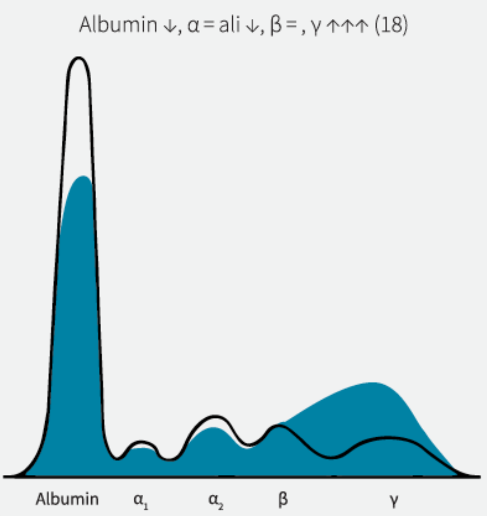 proteinogram 2