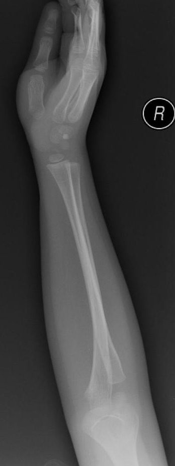 <em>źródło zdjęcia: </em><a style="border-color: hsl(var(--border)); border-image-source: none; --tw-border-spacing-x: 0; --tw-border-spacing-y: 0; --tw-translate-x: 0; --tw-translate-y: 0; --tw-rotate: 0; --tw-skew-x: 0; --tw-skew-y: 0; --tw-scale-x: 1; --tw-scale-y: 1; --tw-pan-x: ; --tw-pan-y: ; --tw-pinch-zoom: ; --tw-scroll-snap-strictness: proximity; --tw-gradient-from-position: ; --tw-gradient-via-position: ; --tw-gradient-to-position: ; --tw-ordinal: ; --tw-slashed-zero: ; --tw-numeric-figure: ; --tw-numeric-spacing: ; --tw-numeric-fraction: ; --tw-ring-inset: ; --tw-ring-offset-width: 0px; --tw-ring-offset-color: #fff; --tw-ring-color: rgba(59,130,246,0.5); --tw-ring-offset-shadow: 0 0 #0000; --tw-ring-shadow: 0 0 #0000; --tw-shadow: 0 0 #0000; --tw-shadow-colored: 0 0 #0000; --tw-blur: ; --tw-brightness: ; --tw-contrast: ; --tw-grayscale: ; --tw-hue-rotate: ; --tw-invert: ; --tw-saturate: ; --tw-sepia: ; --tw-drop-shadow: ; --tw-backdrop-blur: ; --tw-backdrop-brightness: ; --tw-backdrop-contrast: ; --tw-backdrop-grayscale: ; --tw-backdrop-hue-rotate: ; --tw-backdrop-invert: ; --tw-backdrop-opacity: ; --tw-backdrop-saturate: ; --tw-backdrop-sepia: ; outline-color: currentcolor; outline-style: none; text-decoration-style: solid; text-decoration-color: currentcolor;" href="https://doi.org/10.53347/rID-31084"><span style="border-color: hsl(var(--border)); border-image-source: none; --tw-border-spacing-x: 0; --tw-border-spacing-y: 0; --tw-translate-x: 0; --tw-translate-y: 0; --tw-rotate: 0; --tw-skew-x: 0; --tw-skew-y: 0; --tw-scale-x: 1; --tw-scale-y: 1; --tw-pan-x: ; --tw-pan-y: ; --tw-pinch-zoom: ; --tw-scroll-snap-strictness: proximity; --tw-gradient-from-position: ; --tw-gradient-via-position: ; --tw-gradient-to-position: ; --tw-ordinal: ; --tw-slashed-zero: ; --tw-numeric-figure: ; --tw-numeric-spacing: ; --tw-numeric-fraction: ; --tw-ring-inset: ; --tw-ring-offset-width: 0px; --tw-ring-offset-color: #fff; --tw-ring-color: rgba(59,130,246,0.5); --tw-ring-offset-shadow: 0 0 #0000; --tw-ring-shadow: 0 0 #0000; --tw-shadow: 0 0 #0000; --tw-shadow-colored: 0 0 #0000; --tw-blur: ; --tw-brightness: ; --tw-contrast: ; --tw-grayscale: ; --tw-hue-rotate: ; --tw-invert: ; --tw-saturate: ; --tw-sepia: ; --tw-drop-shadow: ; --tw-backdrop-blur: ; --tw-backdrop-brightness: ; --tw-backdrop-contrast: ; --tw-backdrop-grayscale: ; --tw-backdrop-hue-rotate: ; --tw-backdrop-invert: ; --tw-backdrop-opacity: ; --tw-backdrop-saturate: ; --tw-backdrop-sepia: ; outline-color: currentcolor; outline-style: none; font-size: 11pt; font-family: Arial, sans-serif; color: rgb(17, 85, 204); font-style: italic; font-variant-ligatures: normal; font-variant-alternates: normal; font-variant-numeric: normal; font-variant-east-asian: normal; font-variant-position: normal; text-decoration-skip-ink: none; vertical-align: baseline; white-space: pre-wrap;"></span><em style="border-color: hsl(var(--border)); border-image-source: none; --tw-border-spacing-x: 0; --tw-border-spacing-y: 0; --tw-translate-x: 0; --tw-translate-y: 0; --tw-rotate: 0; --tw-skew-x: 0; --tw-skew-y: 0; --tw-scale-x: 1; --tw-scale-y: 1; --tw-pan-x: ; --tw-pan-y: ; --tw-pinch-zoom: ; --tw-scroll-snap-strictness: proximity; --tw-gradient-from-position: ; --tw-gradient-via-position: ; --tw-gradient-to-position: ; --tw-ordinal: ; --tw-slashed-zero: ; --tw-numeric-figure: ; --tw-numeric-spacing: ; --tw-numeric-fraction: ; --tw-ring-inset: ; --tw-ring-offset-width: 0px; --tw-ring-offset-color: #fff; --tw-ring-color: rgba(59,130,246,0.5); --tw-ring-offset-shadow: 0 0 #0000; --tw-ring-shadow: 0 0 #0000; --tw-shadow: 0 0 #0000; --tw-shadow-colored: 0 0 #0000; --tw-blur: ; --tw-brightness: ; --tw-contrast: ; --tw-grayscale: ; --tw-hue-rotate: ; --tw-invert: ; --tw-saturate: ; --tw-sepia: ; --tw-drop-shadow: ; --tw-backdrop-blur: ; --tw-backdrop-brightness: ; --tw-backdrop-contrast: ; --tw-backdrop-grayscale: ; --tw-backdrop-hue-rotate: ; --tw-backdrop-invert: ; --tw-backdrop-opacity: ; --tw-backdrop-saturate: ; --tw-backdrop-sepia: ; outline-color: currentcolor; outline-style: none;"></em><em></em><em>doi.org/10.53347/rID-31084</em></a><em></em>