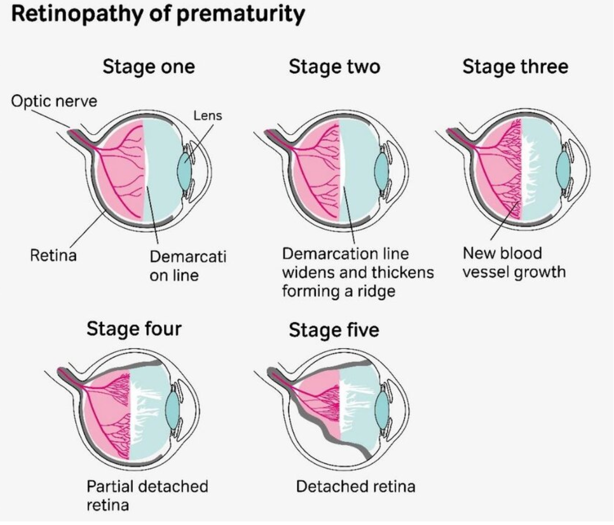 <em>źródło grafiki: doi.irg/</em><a style="border-color: hsl(var(--border)); border-image-source: none; --tw-border-spacing-x: 0; --tw-border-spacing-y: 0; --tw-translate-x: 0; --tw-translate-y: 0; --tw-rotate: 0; --tw-skew-x: 0; --tw-skew-y: 0; --tw-scale-x: 1; --tw-scale-y: 1; --tw-pan-x: ; --tw-pan-y: ; --tw-pinch-zoom: ; --tw-scroll-snap-strictness: proximity; --tw-gradient-from-position: ; --tw-gradient-via-position: ; --tw-gradient-to-position: ; --tw-ordinal: ; --tw-slashed-zero: ; --tw-numeric-figure: ; --tw-numeric-spacing: ; --tw-numeric-fraction: ; --tw-ring-inset: ; --tw-ring-offset-width: 0px; --tw-ring-offset-color: #fff; --tw-ring-color: rgba(59,130,246,0.5); --tw-ring-offset-shadow: 0 0 #0000; --tw-ring-shadow: 0 0 #0000; --tw-shadow: 0 0 #0000; --tw-shadow-colored: 0 0 #0000; --tw-blur: ; --tw-brightness: ; --tw-contrast: ; --tw-grayscale: ; --tw-hue-rotate: ; --tw-invert: ; --tw-saturate: ; --tw-sepia: ; --tw-drop-shadow: ; --tw-backdrop-blur: ; --tw-backdrop-brightness: ; --tw-backdrop-contrast: ; --tw-backdrop-grayscale: ; --tw-backdrop-hue-rotate: ; --tw-backdrop-invert: ; --tw-backdrop-opacity: ; --tw-backdrop-saturate: ; --tw-backdrop-sepia: ; outline-color: currentcolor; outline-style: none; text-decoration-style: solid; text-decoration-color: currentcolor;" href="https://doi.org/10.13140/RG.2.2.30158.84809"><span style="border-color: hsl(var(--border)); border-image-source: none; --tw-border-spacing-x: 0; --tw-border-spacing-y: 0; --tw-translate-x: 0; --tw-translate-y: 0; --tw-rotate: 0; --tw-skew-x: 0; --tw-skew-y: 0; --tw-scale-x: 1; --tw-scale-y: 1; --tw-pan-x: ; --tw-pan-y: ; --tw-pinch-zoom: ; --tw-scroll-snap-strictness: proximity; --tw-gradient-from-position: ; --tw-gradient-via-position: ; --tw-gradient-to-position: ; --tw-ordinal: ; --tw-slashed-zero: ; --tw-numeric-figure: ; --tw-numeric-spacing: ; --tw-numeric-fraction: ; --tw-ring-inset: ; --tw-ring-offset-width: 0px; --tw-ring-offset-color: #fff; --tw-ring-color: rgba(59,130,246,0.5); --tw-ring-offset-shadow: 0 0 #0000; --tw-ring-shadow: 0 0 #0000; --tw-shadow: 0 0 #0000; --tw-shadow-colored: 0 0 #0000; --tw-blur: ; --tw-brightness: ; --tw-contrast: ; --tw-grayscale: ; --tw-hue-rotate: ; --tw-invert: ; --tw-saturate: ; --tw-sepia: ; --tw-drop-shadow: ; --tw-backdrop-blur: ; --tw-backdrop-brightness: ; --tw-backdrop-contrast: ; --tw-backdrop-grayscale: ; --tw-backdrop-hue-rotate: ; --tw-backdrop-invert: ; --tw-backdrop-opacity: ; --tw-backdrop-saturate: ; --tw-backdrop-sepia: ; outline-color: currentcolor; outline-style: none; font-size: 10.5pt; font-family: Roboto, sans-serif; color: rgb(17, 85, 204); font-style: italic; font-variant-ligatures: normal; font-variant-alternates: normal; font-variant-numeric: normal; font-variant-east-asian: normal; font-variant-position: normal; text-decoration-skip-ink: none; vertical-align: baseline; white-space: pre-wrap;"></span><em style="border-color: hsl(var(--border)); border-image-source: none; --tw-border-spacing-x: 0; --tw-border-spacing-y: 0; --tw-translate-x: 0; --tw-translate-y: 0; --tw-rotate: 0; --tw-skew-x: 0; --tw-skew-y: 0; --tw-scale-x: 1; --tw-scale-y: 1; --tw-pan-x: ; --tw-pan-y: ; --tw-pinch-zoom: ; --tw-scroll-snap-strictness: proximity; --tw-gradient-from-position: ; --tw-gradient-via-position: ; --tw-gradient-to-position: ; --tw-ordinal: ; --tw-slashed-zero: ; --tw-numeric-figure: ; --tw-numeric-spacing: ; --tw-numeric-fraction: ; --tw-ring-inset: ; --tw-ring-offset-width: 0px; --tw-ring-offset-color: #fff; --tw-ring-color: rgba(59,130,246,0.5); --tw-ring-offset-shadow: 0 0 #0000; --tw-ring-shadow: 0 0 #0000; --tw-shadow: 0 0 #0000; --tw-shadow-colored: 0 0 #0000; --tw-blur: ; --tw-brightness: ; --tw-contrast: ; --tw-grayscale: ; --tw-hue-rotate: ; --tw-invert: ; --tw-saturate: ; --tw-sepia: ; --tw-drop-shadow: ; --tw-backdrop-blur: ; --tw-backdrop-brightness: ; --tw-backdrop-contrast: ; --tw-backdrop-grayscale: ; --tw-backdrop-hue-rotate: ; --tw-backdrop-invert: ; --tw-backdrop-opacity: ; --tw-backdrop-saturate: ; --tw-backdrop-sepia: ; outline-color: currentcolor; outline-style: none;"></em><em></em><em>10.13140/RG.2.2.30158.84809</em></a>