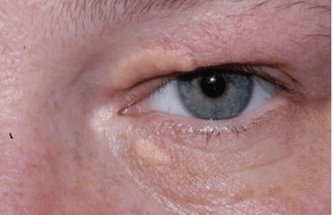 <em>źródło zdjęcia: </em><a style="border-color: hsl(var(--border)); border-image-source: none; --tw-border-spacing-x: 0; --tw-border-spacing-y: 0; --tw-translate-x: 0; --tw-translate-y: 0; --tw-rotate: 0; --tw-skew-x: 0; --tw-skew-y: 0; --tw-scale-x: 1; --tw-scale-y: 1; --tw-pan-x: ; --tw-pan-y: ; --tw-pinch-zoom: ; --tw-scroll-snap-strictness: proximity; --tw-gradient-from-position: ; --tw-gradient-via-position: ; --tw-gradient-to-position: ; --tw-ordinal: ; --tw-slashed-zero: ; --tw-numeric-figure: ; --tw-numeric-spacing: ; --tw-numeric-fraction: ; --tw-ring-inset: ; --tw-ring-offset-width: 0px; --tw-ring-offset-color: #fff; --tw-ring-color: rgba(59,130,246,0.5); --tw-ring-offset-shadow: 0 0 #0000; --tw-ring-shadow: 0 0 #0000; --tw-shadow: 0 0 #0000; --tw-shadow-colored: 0 0 #0000; --tw-blur: ; --tw-brightness: ; --tw-contrast: ; --tw-grayscale: ; --tw-hue-rotate: ; --tw-invert: ; --tw-saturate: ; --tw-sepia: ; --tw-drop-shadow: ; --tw-backdrop-blur: ; --tw-backdrop-brightness: ; --tw-backdrop-contrast: ; --tw-backdrop-grayscale: ; --tw-backdrop-hue-rotate: ; --tw-backdrop-invert: ; --tw-backdrop-opacity: ; --tw-backdrop-saturate: ; --tw-backdrop-sepia: ; outline-color: currentcolor; outline-style: none; text-decoration-style: solid; text-decoration-color: currentcolor;" href="http://doi.org/10.1007/978-3-642-35951-4_899-1"><span style="border-color: hsl(var(--border)); border-image-source: none; --tw-border-spacing-x: 0; --tw-border-spacing-y: 0; --tw-translate-x: 0; --tw-translate-y: 0; --tw-rotate: 0; --tw-skew-x: 0; --tw-skew-y: 0; --tw-scale-x: 1; --tw-scale-y: 1; --tw-pan-x: ; --tw-pan-y: ; --tw-pinch-zoom: ; --tw-scroll-snap-strictness: proximity; --tw-gradient-from-position: ; --tw-gradient-via-position: ; --tw-gradient-to-position: ; --tw-ordinal: ; --tw-slashed-zero: ; --tw-numeric-figure: ; --tw-numeric-spacing: ; --tw-numeric-fraction: ; --tw-ring-inset: ; --tw-ring-offset-width: 0px; --tw-ring-offset-color: #fff; --tw-ring-color: rgba(59,130,246,0.5); --tw-ring-offset-shadow: 0 0 #0000; --tw-ring-shadow: 0 0 #0000; --tw-shadow: 0 0 #0000; --tw-shadow-colored: 0 0 #0000; --tw-blur: ; --tw-brightness: ; --tw-contrast: ; --tw-grayscale: ; --tw-hue-rotate: ; --tw-invert: ; --tw-saturate: ; --tw-sepia: ; --tw-drop-shadow: ; --tw-backdrop-blur: ; --tw-backdrop-brightness: ; --tw-backdrop-contrast: ; --tw-backdrop-grayscale: ; --tw-backdrop-hue-rotate: ; --tw-backdrop-invert: ; --tw-backdrop-opacity: ; --tw-backdrop-saturate: ; --tw-backdrop-sepia: ; outline-color: currentcolor; outline-style: none; font-size: 11pt; font-family: Arial, sans-serif; color: rgb(17, 85, 204); font-style: italic; font-variant-ligatures: normal; font-variant-alternates: normal; font-variant-numeric: normal; font-variant-east-asian: normal; font-variant-position: normal; text-decoration-skip-ink: none; vertical-align: baseline; white-space: pre-wrap;"></span><em style="border-color: hsl(var(--border)); border-image-source: none; --tw-border-spacing-x: 0; --tw-border-spacing-y: 0; --tw-translate-x: 0; --tw-translate-y: 0; --tw-rotate: 0; --tw-skew-x: 0; --tw-skew-y: 0; --tw-scale-x: 1; --tw-scale-y: 1; --tw-pan-x: ; --tw-pan-y: ; --tw-pinch-zoom: ; --tw-scroll-snap-strictness: proximity; --tw-gradient-from-position: ; --tw-gradient-via-position: ; --tw-gradient-to-position: ; --tw-ordinal: ; --tw-slashed-zero: ; --tw-numeric-figure: ; --tw-numeric-spacing: ; --tw-numeric-fraction: ; --tw-ring-inset: ; --tw-ring-offset-width: 0px; --tw-ring-offset-color: #fff; --tw-ring-color: rgba(59,130,246,0.5); --tw-ring-offset-shadow: 0 0 #0000; --tw-ring-shadow: 0 0 #0000; --tw-shadow: 0 0 #0000; --tw-shadow-colored: 0 0 #0000; --tw-blur: ; --tw-brightness: ; --tw-contrast: ; --tw-grayscale: ; --tw-hue-rotate: ; --tw-invert: ; --tw-saturate: ; --tw-sepia: ; --tw-drop-shadow: ; --tw-backdrop-blur: ; --tw-backdrop-brightness: ; --tw-backdrop-contrast: ; --tw-backdrop-grayscale: ; --tw-backdrop-hue-rotate: ; --tw-backdrop-invert: ; --tw-backdrop-opacity: ; --tw-backdrop-saturate: ; --tw-backdrop-sepia: ; outline-color: currentcolor; outline-style: none;"></em><em style="border-color: hsl(var(--border)); border-image-source: none; --tw-border-spacing-x: 0; --tw-border-spacing-y: 0; --tw-translate-x: 0; --tw-translate-y: 0; --tw-rotate: 0; --tw-skew-x: 0; --tw-skew-y: 0; --tw-scale-x: 1; --tw-scale-y: 1; --tw-pan-x: ; --tw-pan-y: ; --tw-pinch-zoom: ; --tw-scroll-snap-strictness: proximity; --tw-gradient-from-position: ; --tw-gradient-via-position: ; --tw-gradient-to-position: ; --tw-ordinal: ; --tw-slashed-zero: ; --tw-numeric-figure: ; --tw-numeric-spacing: ; --tw-numeric-fraction: ; --tw-ring-inset: ; --tw-ring-offset-width: 0px; --tw-ring-offset-color: #fff; --tw-ring-color: rgba(59,130,246,0.5); --tw-ring-offset-shadow: 0 0 #0000; --tw-ring-shadow: 0 0 #0000; --tw-shadow: 0 0 #0000; --tw-shadow-colored: 0 0 #0000; --tw-blur: ; --tw-brightness: ; --tw-contrast: ; --tw-grayscale: ; --tw-hue-rotate: ; --tw-invert: ; --tw-saturate: ; --tw-sepia: ; --tw-drop-shadow: ; --tw-backdrop-blur: ; --tw-backdrop-brightness: ; --tw-backdrop-contrast: ; --tw-backdrop-grayscale: ; --tw-backdrop-hue-rotate: ; --tw-backdrop-invert: ; --tw-backdrop-opacity: ; --tw-backdrop-saturate: ; --tw-backdrop-sepia: ; outline-color: currentcolor; outline-style: none;"></em><em style="border-color: hsl(var(--border)); border-image-source: none; --tw-border-spacing-x: 0; --tw-border-spacing-y: 0; --tw-translate-x: 0; --tw-translate-y: 0; --tw-rotate: 0; --tw-skew-x: 0; --tw-skew-y: 0; --tw-scale-x: 1; --tw-scale-y: 1; --tw-pan-x: ; --tw-pan-y: ; --tw-pinch-zoom: ; --tw-scroll-snap-strictness: proximity; --tw-gradient-from-position: ; --tw-gradient-via-position: ; --tw-gradient-to-position: ; --tw-ordinal: ; --tw-slashed-zero: ; --tw-numeric-figure: ; --tw-numeric-spacing: ; --tw-numeric-fraction: ; --tw-ring-inset: ; --tw-ring-offset-width: 0px; --tw-ring-offset-color: #fff; --tw-ring-color: rgba(59,130,246,0.5); --tw-ring-offset-shadow: 0 0 #0000; --tw-ring-shadow: 0 0 #0000; --tw-shadow: 0 0 #0000; --tw-shadow-colored: 0 0 #0000; --tw-blur: ; --tw-brightness: ; --tw-contrast: ; --tw-grayscale: ; --tw-hue-rotate: ; --tw-invert: ; --tw-saturate: ; --tw-sepia: ; --tw-drop-shadow: ; --tw-backdrop-blur: ; --tw-backdrop-brightness: ; --tw-backdrop-contrast: ; --tw-backdrop-grayscale: ; --tw-backdrop-hue-rotate: ; --tw-backdrop-invert: ; --tw-backdrop-opacity: ; --tw-backdrop-saturate: ; --tw-backdrop-sepia: ; outline-color: currentcolor; outline-style: none;"></em><em></em><em></em><em></em><em>doi.org/10.1007/978-3-642-35951-4_899-1</em></a>