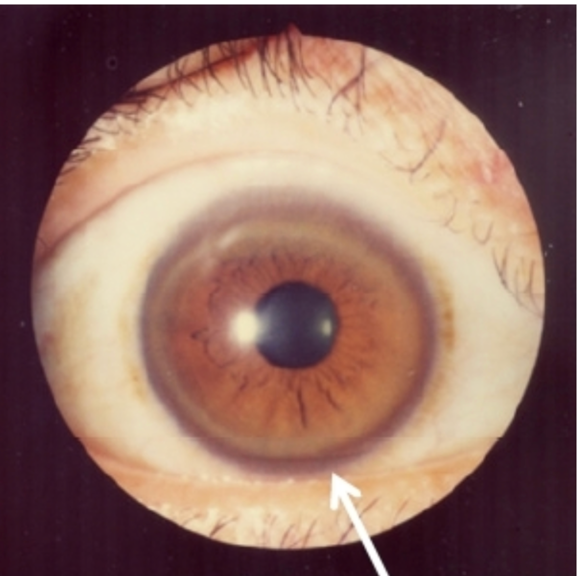 <em>źródło zdjęcia: doi.org/</em><a style="border-color: hsl(var(--border)); border-image-source: none; --tw-border-spacing-x: 0; --tw-border-spacing-y: 0; --tw-translate-x: 0; --tw-translate-y: 0; --tw-rotate: 0; --tw-skew-x: 0; --tw-skew-y: 0; --tw-scale-x: 1; --tw-scale-y: 1; --tw-pan-x: ; --tw-pan-y: ; --tw-pinch-zoom: ; --tw-scroll-snap-strictness: proximity; --tw-gradient-from-position: ; --tw-gradient-via-position: ; --tw-gradient-to-position: ; --tw-ordinal: ; --tw-slashed-zero: ; --tw-numeric-figure: ; --tw-numeric-spacing: ; --tw-numeric-fraction: ; --tw-ring-inset: ; --tw-ring-offset-width: 0px; --tw-ring-offset-color: #fff; --tw-ring-color: rgba(59,130,246,0.5); --tw-ring-offset-shadow: 0 0 #0000; --tw-ring-shadow: 0 0 #0000; --tw-shadow: 0 0 #0000; --tw-shadow-colored: 0 0 #0000; --tw-blur: ; --tw-brightness: ; --tw-contrast: ; --tw-grayscale: ; --tw-hue-rotate: ; --tw-invert: ; --tw-saturate: ; --tw-sepia: ; --tw-drop-shadow: ; --tw-backdrop-blur: ; --tw-backdrop-brightness: ; --tw-backdrop-contrast: ; --tw-backdrop-grayscale: ; --tw-backdrop-hue-rotate: ; --tw-backdrop-invert: ; --tw-backdrop-opacity: ; --tw-backdrop-saturate: ; --tw-backdrop-sepia: ; outline-color: currentcolor; outline-style: none; text-decoration-style: solid; text-decoration-color: currentcolor;" href="https://doi.org/10.2174/138920012799320455" rel="nofollow noopener"><span style="border-color: hsl(var(--border)); border-image-source: none; --tw-border-spacing-x: 0; --tw-border-spacing-y: 0; --tw-translate-x: 0; --tw-translate-y: 0; --tw-rotate: 0; --tw-skew-x: 0; --tw-skew-y: 0; --tw-scale-x: 1; --tw-scale-y: 1; --tw-pan-x: ; --tw-pan-y: ; --tw-pinch-zoom: ; --tw-scroll-snap-strictness: proximity; --tw-gradient-from-position: ; --tw-gradient-via-position: ; --tw-gradient-to-position: ; --tw-ordinal: ; --tw-slashed-zero: ; --tw-numeric-figure: ; --tw-numeric-spacing: ; --tw-numeric-fraction: ; --tw-ring-inset: ; --tw-ring-offset-width: 0px; --tw-ring-offset-color: #fff; --tw-ring-color: rgba(59,130,246,0.5); --tw-ring-offset-shadow: 0 0 #0000; --tw-ring-shadow: 0 0 #0000; --tw-shadow: 0 0 #0000; --tw-shadow-colored: 0 0 #0000; --tw-blur: ; --tw-brightness: ; --tw-contrast: ; --tw-grayscale: ; --tw-hue-rotate: ; --tw-invert: ; --tw-saturate: ; --tw-sepia: ; --tw-drop-shadow: ; --tw-backdrop-blur: ; --tw-backdrop-brightness: ; --tw-backdrop-contrast: ; --tw-backdrop-grayscale: ; --tw-backdrop-hue-rotate: ; --tw-backdrop-invert: ; --tw-backdrop-opacity: ; --tw-backdrop-saturate: ; --tw-backdrop-sepia: ; outline-color: currentcolor; outline-style: none;"></span><em style="border-color: hsl(var(--border)); border-image-source: none; --tw-border-spacing-x: 0; --tw-border-spacing-y: 0; --tw-translate-x: 0; --tw-translate-y: 0; --tw-rotate: 0; --tw-skew-x: 0; --tw-skew-y: 0; --tw-scale-x: 1; --tw-scale-y: 1; --tw-pan-x: ; --tw-pan-y: ; --tw-pinch-zoom: ; --tw-scroll-snap-strictness: proximity; --tw-gradient-from-position: ; --tw-gradient-via-position: ; --tw-gradient-to-position: ; --tw-ordinal: ; --tw-slashed-zero: ; --tw-numeric-figure: ; --tw-numeric-spacing: ; --tw-numeric-fraction: ; --tw-ring-inset: ; --tw-ring-offset-width: 0px; --tw-ring-offset-color: #fff; --tw-ring-color: rgba(59,130,246,0.5); --tw-ring-offset-shadow: 0 0 #0000; --tw-ring-shadow: 0 0 #0000; --tw-shadow: 0 0 #0000; --tw-shadow-colored: 0 0 #0000; --tw-blur: ; --tw-brightness: ; --tw-contrast: ; --tw-grayscale: ; --tw-hue-rotate: ; --tw-invert: ; --tw-saturate: ; --tw-sepia: ; --tw-drop-shadow: ; --tw-backdrop-blur: ; --tw-backdrop-brightness: ; --tw-backdrop-contrast: ; --tw-backdrop-grayscale: ; --tw-backdrop-hue-rotate: ; --tw-backdrop-invert: ; --tw-backdrop-opacity: ; --tw-backdrop-saturate: ; --tw-backdrop-sepia: ; outline-color: currentcolor; outline-style: none;"></em><em>10.2174/138920012799320455</em></a>