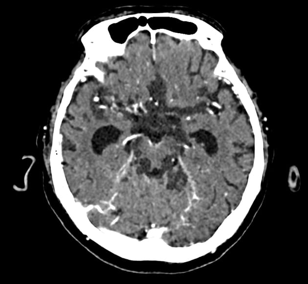 <em>źródło zdjęcia: </em><a style="--tw-border-spacing-x: 0; --tw-border-spacing-y: 0; --tw-translate-x: 0; --tw-translate-y: 0; --tw-rotate: 0; --tw-skew-x: 0; --tw-skew-y: 0; --tw-scale-x: 1; --tw-scale-y: 1; --tw-pan-x: ; --tw-pan-y: ; --tw-pinch-zoom: ; --tw-scroll-snap-strictness: proximity; --tw-gradient-from-position: ; --tw-gradient-via-position: ; --tw-gradient-to-position: ; --tw-ordinal: ; --tw-slashed-zero: ; --tw-numeric-figure: ; --tw-numeric-spacing: ; --tw-numeric-fraction: ; --tw-ring-inset: ; --tw-ring-offset-width: 0px; --tw-ring-offset-color: #fff; --tw-ring-color: rgba(59,130,246,0.5); --tw-ring-offset-shadow: 0 0 #0000; --tw-ring-shadow: 0 0 #0000; --tw-shadow: 0 0 #0000; --tw-shadow-colored: 0 0 #0000; --tw-blur: ; --tw-brightness: ; --tw-contrast: ; --tw-grayscale: ; --tw-hue-rotate: ; --tw-invert: ; --tw-saturate: ; --tw-sepia: ; --tw-drop-shadow: ; --tw-backdrop-blur: ; --tw-backdrop-brightness: ; --tw-backdrop-contrast: ; --tw-backdrop-grayscale: ; --tw-backdrop-hue-rotate: ; --tw-backdrop-invert: ; --tw-backdrop-opacity: ; --tw-backdrop-saturate: ; --tw-backdrop-sepia: ; border-color: hsl(var(--border)); border-image-source: none; outline-color: currentcolor; outline-style: none; text-decoration-style: solid; text-decoration-color: currentcolor;" href="http://doi.org/10.53347/rID-16416"><span style="--tw-border-spacing-x: 0; --tw-border-spacing-y: 0; --tw-translate-x: 0; --tw-translate-y: 0; --tw-rotate: 0; --tw-skew-x: 0; --tw-skew-y: 0; --tw-scale-x: 1; --tw-scale-y: 1; --tw-pan-x: ; --tw-pan-y: ; --tw-pinch-zoom: ; --tw-scroll-snap-strictness: proximity; --tw-gradient-from-position: ; --tw-gradient-via-position: ; --tw-gradient-to-position: ; --tw-ordinal: ; --tw-slashed-zero: ; --tw-numeric-figure: ; --tw-numeric-spacing: ; --tw-numeric-fraction: ; --tw-ring-inset: ; --tw-ring-offset-width: 0px; --tw-ring-offset-color: #fff; --tw-ring-color: rgba(59,130,246,0.5); --tw-ring-offset-shadow: 0 0 #0000; --tw-ring-shadow: 0 0 #0000; --tw-shadow: 0 0 #0000; --tw-shadow-colored: 0 0 #0000; --tw-blur: ; --tw-brightness: ; --tw-contrast: ; --tw-grayscale: ; --tw-hue-rotate: ; --tw-invert: ; --tw-saturate: ; --tw-sepia: ; --tw-drop-shadow: ; --tw-backdrop-blur: ; --tw-backdrop-brightness: ; --tw-backdrop-contrast: ; --tw-backdrop-grayscale: ; --tw-backdrop-hue-rotate: ; --tw-backdrop-invert: ; --tw-backdrop-opacity: ; --tw-backdrop-saturate: ; --tw-backdrop-sepia: ; border-color: hsl(var(--border)); border-image-source: none; outline-color: currentcolor; outline-style: none; font-size: 11pt; font-family: Arial, sans-serif; color: rgb(17, 85, 204); font-style: italic; font-variant-ligatures: normal; font-variant-alternates: normal; font-variant-numeric: normal; font-variant-east-asian: normal; font-variant-position: normal; text-decoration-skip-ink: none; vertical-align: baseline; white-space: pre-wrap;"></span><em style="--tw-border-spacing-x: 0; --tw-border-spacing-y: 0; --tw-translate-x: 0; --tw-translate-y: 0; --tw-rotate: 0; --tw-skew-x: 0; --tw-skew-y: 0; --tw-scale-x: 1; --tw-scale-y: 1; --tw-pan-x: ; --tw-pan-y: ; --tw-pinch-zoom: ; --tw-scroll-snap-strictness: proximity; --tw-gradient-from-position: ; --tw-gradient-via-position: ; --tw-gradient-to-position: ; --tw-ordinal: ; --tw-slashed-zero: ; --tw-numeric-figure: ; --tw-numeric-spacing: ; --tw-numeric-fraction: ; --tw-ring-inset: ; --tw-ring-offset-width: 0px; --tw-ring-offset-color: #fff; --tw-ring-color: rgba(59,130,246,0.5); --tw-ring-offset-shadow: 0 0 #0000; --tw-ring-shadow: 0 0 #0000; --tw-shadow: 0 0 #0000; --tw-shadow-colored: 0 0 #0000; --tw-blur: ; --tw-brightness: ; --tw-contrast: ; --tw-grayscale: ; --tw-hue-rotate: ; --tw-invert: ; --tw-saturate: ; --tw-sepia: ; --tw-drop-shadow: ; --tw-backdrop-blur: ; --tw-backdrop-brightness: ; --tw-backdrop-contrast: ; --tw-backdrop-grayscale: ; --tw-backdrop-hue-rotate: ; --tw-backdrop-invert: ; --tw-backdrop-opacity: ; --tw-backdrop-saturate: ; --tw-backdrop-sepia: ; border-color: hsl(var(--border)); border-image-source: none; outline-color: currentcolor; outline-style: none;"></em><em></em><em>doi.org/10.53347/rID-16416</em></a><em></em>