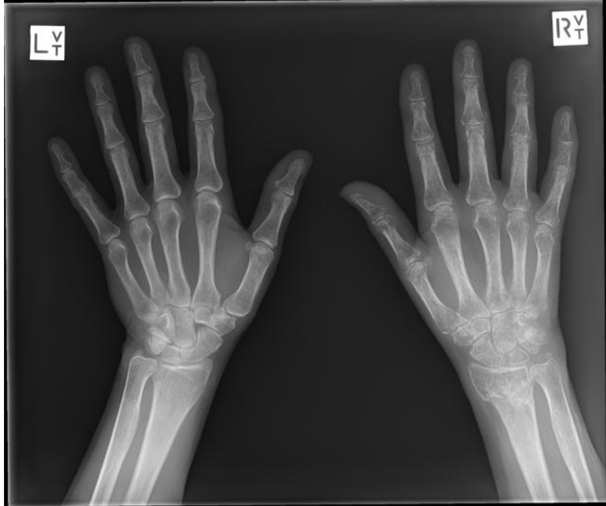 <em>źródło zdjęcia: </em><a style="--tw-border-spacing-x: 0; --tw-border-spacing-y: 0; --tw-translate-x: 0; --tw-translate-y: 0; --tw-rotate: 0; --tw-skew-x: 0; --tw-skew-y: 0; --tw-scale-x: 1; --tw-scale-y: 1; --tw-pan-x: ; --tw-pan-y: ; --tw-pinch-zoom: ; --tw-scroll-snap-strictness: proximity; --tw-gradient-from-position: ; --tw-gradient-via-position: ; --tw-gradient-to-position: ; --tw-ordinal: ; --tw-slashed-zero: ; --tw-numeric-figure: ; --tw-numeric-spacing: ; --tw-numeric-fraction: ; --tw-ring-inset: ; --tw-ring-offset-width: 0px; --tw-ring-offset-color: #fff; --tw-ring-color: rgba(59,130,246,0.5); --tw-ring-offset-shadow: 0 0 #0000; --tw-ring-shadow: 0 0 #0000; --tw-shadow: 0 0 #0000; --tw-shadow-colored: 0 0 #0000; --tw-blur: ; --tw-brightness: ; --tw-contrast: ; --tw-grayscale: ; --tw-hue-rotate: ; --tw-invert: ; --tw-saturate: ; --tw-sepia: ; --tw-drop-shadow: ; --tw-backdrop-blur: ; --tw-backdrop-brightness: ; --tw-backdrop-contrast: ; --tw-backdrop-grayscale: ; --tw-backdrop-hue-rotate: ; --tw-backdrop-invert: ; --tw-backdrop-opacity: ; --tw-backdrop-saturate: ; --tw-backdrop-sepia: ; border-color: hsl(var(--border)); border-image-source: none; outline-color: currentcolor; outline-style: none; text-decoration-style: solid; text-decoration-color: currentcolor;" href="http://doi.org/10.53347/rID-1154"><span style="--tw-border-spacing-x: 0; --tw-border-spacing-y: 0; --tw-translate-x: 0; --tw-translate-y: 0; --tw-rotate: 0; --tw-skew-x: 0; --tw-skew-y: 0; --tw-scale-x: 1; --tw-scale-y: 1; --tw-pan-x: ; --tw-pan-y: ; --tw-pinch-zoom: ; --tw-scroll-snap-strictness: proximity; --tw-gradient-from-position: ; --tw-gradient-via-position: ; --tw-gradient-to-position: ; --tw-ordinal: ; --tw-slashed-zero: ; --tw-numeric-figure: ; --tw-numeric-spacing: ; --tw-numeric-fraction: ; --tw-ring-inset: ; --tw-ring-offset-width: 0px; --tw-ring-offset-color: #fff; --tw-ring-color: rgba(59,130,246,0.5); --tw-ring-offset-shadow: 0 0 #0000; --tw-ring-shadow: 0 0 #0000; --tw-shadow: 0 0 #0000; --tw-shadow-colored: 0 0 #0000; --tw-blur: ; --tw-brightness: ; --tw-contrast: ; --tw-grayscale: ; --tw-hue-rotate: ; --tw-invert: ; --tw-saturate: ; --tw-sepia: ; --tw-drop-shadow: ; --tw-backdrop-blur: ; --tw-backdrop-brightness: ; --tw-backdrop-contrast: ; --tw-backdrop-grayscale: ; --tw-backdrop-hue-rotate: ; --tw-backdrop-invert: ; --tw-backdrop-opacity: ; --tw-backdrop-saturate: ; --tw-backdrop-sepia: ; border-color: hsl(var(--border)); border-image-source: none; outline-color: currentcolor; outline-style: none; font-size: 11pt; font-family: Arial, sans-serif; color: rgb(17, 85, 204); font-style: italic; font-variant-ligatures: normal; font-variant-alternates: normal; font-variant-numeric: normal; font-variant-east-asian: normal; font-variant-position: normal; text-decoration: none; vertical-align: baseline; white-space: pre-wrap;"></span><em style="--tw-border-spacing-x: 0; --tw-border-spacing-y: 0; --tw-translate-x: 0; --tw-translate-y: 0; --tw-rotate: 0; --tw-skew-x: 0; --tw-skew-y: 0; --tw-scale-x: 1; --tw-scale-y: 1; --tw-pan-x: ; --tw-pan-y: ; --tw-pinch-zoom: ; --tw-scroll-snap-strictness: proximity; --tw-gradient-from-position: ; --tw-gradient-via-position: ; --tw-gradient-to-position: ; --tw-ordinal: ; --tw-slashed-zero: ; --tw-numeric-figure: ; --tw-numeric-spacing: ; --tw-numeric-fraction: ; --tw-ring-inset: ; --tw-ring-offset-width: 0px; --tw-ring-offset-color: #fff; --tw-ring-color: rgba(59,130,246,0.5); --tw-ring-offset-shadow: 0 0 #0000; --tw-ring-shadow: 0 0 #0000; --tw-shadow: 0 0 #0000; --tw-shadow-colored: 0 0 #0000; --tw-blur: ; --tw-brightness: ; --tw-contrast: ; --tw-grayscale: ; --tw-hue-rotate: ; --tw-invert: ; --tw-saturate: ; --tw-sepia: ; --tw-drop-shadow: ; --tw-backdrop-blur: ; --tw-backdrop-brightness: ; --tw-backdrop-contrast: ; --tw-backdrop-grayscale: ; --tw-backdrop-hue-rotate: ; --tw-backdrop-invert: ; --tw-backdrop-opacity: ; --tw-backdrop-saturate: ; --tw-backdrop-sepia: ; border-color: hsl(var(--border)); border-image-source: none; outline-color: currentcolor; outline-style: none;"></em><em></em><em>doi.org/10.53347/rID-1154</em></a><em></em>