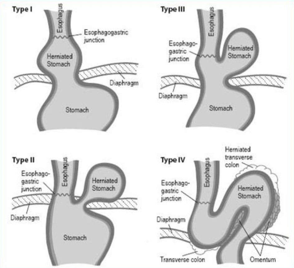 <em>źródło schematu: </em><a style="--tw-border-spacing-x: 0; --tw-border-spacing-y: 0; --tw-translate-x: 0; --tw-translate-y: 0; --tw-rotate: 0; --tw-skew-x: 0; --tw-skew-y: 0; --tw-scale-x: 1; --tw-scale-y: 1; --tw-pan-x: ; --tw-pan-y: ; --tw-pinch-zoom: ; --tw-scroll-snap-strictness: proximity; --tw-gradient-from-position: ; --tw-gradient-via-position: ; --tw-gradient-to-position: ; --tw-ordinal: ; --tw-slashed-zero: ; --tw-numeric-figure: ; --tw-numeric-spacing: ; --tw-numeric-fraction: ; --tw-ring-inset: ; --tw-ring-offset-width: 0px; --tw-ring-offset-color: #fff; --tw-ring-color: rgba(59,130,246,0.5); --tw-ring-offset-shadow: 0 0 #0000; --tw-ring-shadow: 0 0 #0000; --tw-shadow: 0 0 #0000; --tw-shadow-colored: 0 0 #0000; --tw-blur: ; --tw-brightness: ; --tw-contrast: ; --tw-grayscale: ; --tw-hue-rotate: ; --tw-invert: ; --tw-saturate: ; --tw-sepia: ; --tw-drop-shadow: ; --tw-backdrop-blur: ; --tw-backdrop-brightness: ; --tw-backdrop-contrast: ; --tw-backdrop-grayscale: ; --tw-backdrop-hue-rotate: ; --tw-backdrop-invert: ; --tw-backdrop-opacity: ; --tw-backdrop-saturate: ; --tw-backdrop-sepia: ; border-color: hsl(var(--border)); border-image-source: none; outline-color: currentcolor; outline-style: none; text-decoration-style: solid; text-decoration-color: currentcolor;" href="http://doi.org/10.1007/978-88-470-3944-5_17"><span style="--tw-border-spacing-x: 0; --tw-border-spacing-y: 0; --tw-translate-x: 0; --tw-translate-y: 0; --tw-rotate: 0; --tw-skew-x: 0; --tw-skew-y: 0; --tw-scale-x: 1; --tw-scale-y: 1; --tw-pan-x: ; --tw-pan-y: ; --tw-pinch-zoom: ; --tw-scroll-snap-strictness: proximity; --tw-gradient-from-position: ; --tw-gradient-via-position: ; --tw-gradient-to-position: ; --tw-ordinal: ; --tw-slashed-zero: ; --tw-numeric-figure: ; --tw-numeric-spacing: ; --tw-numeric-fraction: ; --tw-ring-inset: ; --tw-ring-offset-width: 0px; --tw-ring-offset-color: #fff; --tw-ring-color: rgba(59,130,246,0.5); --tw-ring-offset-shadow: 0 0 #0000; --tw-ring-shadow: 0 0 #0000; --tw-shadow: 0 0 #0000; --tw-shadow-colored: 0 0 #0000; --tw-blur: ; --tw-brightness: ; --tw-contrast: ; --tw-grayscale: ; --tw-hue-rotate: ; --tw-invert: ; --tw-saturate: ; --tw-sepia: ; --tw-drop-shadow: ; --tw-backdrop-blur: ; --tw-backdrop-brightness: ; --tw-backdrop-contrast: ; --tw-backdrop-grayscale: ; --tw-backdrop-hue-rotate: ; --tw-backdrop-invert: ; --tw-backdrop-opacity: ; --tw-backdrop-saturate: ; --tw-backdrop-sepia: ; border-color: hsl(var(--border)); border-image-source: none; outline-color: currentcolor; outline-style: none; font-size: 11pt; font-family: Arial, sans-serif; color: rgb(17, 85, 204); font-style: italic; font-variant-ligatures: normal; font-variant-alternates: normal; font-variant-numeric: normal; font-variant-east-asian: normal; font-variant-position: normal; text-decoration-skip-ink: none; vertical-align: baseline; white-space: pre-wrap;"></span><em style="--tw-border-spacing-x: 0; --tw-border-spacing-y: 0; --tw-translate-x: 0; --tw-translate-y: 0; --tw-rotate: 0; --tw-skew-x: 0; --tw-skew-y: 0; --tw-scale-x: 1; --tw-scale-y: 1; --tw-pan-x: ; --tw-pan-y: ; --tw-pinch-zoom: ; --tw-scroll-snap-strictness: proximity; --tw-gradient-from-position: ; --tw-gradient-via-position: ; --tw-gradient-to-position: ; --tw-ordinal: ; --tw-slashed-zero: ; --tw-numeric-figure: ; --tw-numeric-spacing: ; --tw-numeric-fraction: ; --tw-ring-inset: ; --tw-ring-offset-width: 0px; --tw-ring-offset-color: #fff; --tw-ring-color: rgba(59,130,246,0.5); --tw-ring-offset-shadow: 0 0 #0000; --tw-ring-shadow: 0 0 #0000; --tw-shadow: 0 0 #0000; --tw-shadow-colored: 0 0 #0000; --tw-blur: ; --tw-brightness: ; --tw-contrast: ; --tw-grayscale: ; --tw-hue-rotate: ; --tw-invert: ; --tw-saturate: ; --tw-sepia: ; --tw-drop-shadow: ; --tw-backdrop-blur: ; --tw-backdrop-brightness: ; --tw-backdrop-contrast: ; --tw-backdrop-grayscale: ; --tw-backdrop-hue-rotate: ; --tw-backdrop-invert: ; --tw-backdrop-opacity: ; --tw-backdrop-saturate: ; --tw-backdrop-sepia: ; border-color: hsl(var(--border)); border-image-source: none; outline-color: currentcolor; outline-style: none;"></em><em></em><em>doi.org/10.1007/978-88-470-3944-5_17</em></a><em></em>
