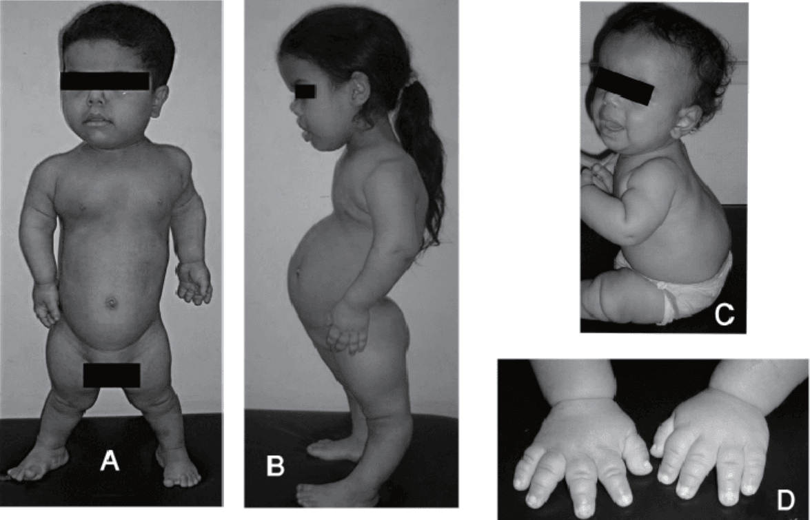 <em>źródło zdjęć: </em><a style="text-decoration: none;" href="https://www.researchgate.net/publication/216381682"><span style="font-size: 11pt; font-family: Arial, sans-serif; color: rgb(17, 85, 204); font-style: italic; font-variant-ligatures: normal; font-variant-alternates: normal; font-variant-numeric: normal; font-variant-east-asian: normal; font-variant-position: normal; text-decoration: underline; text-decoration-skip-ink: none; vertical-align: baseline; white-space: pre-wrap;"></span><em>https://www.researchgate.net/publication/216381682</em></a>