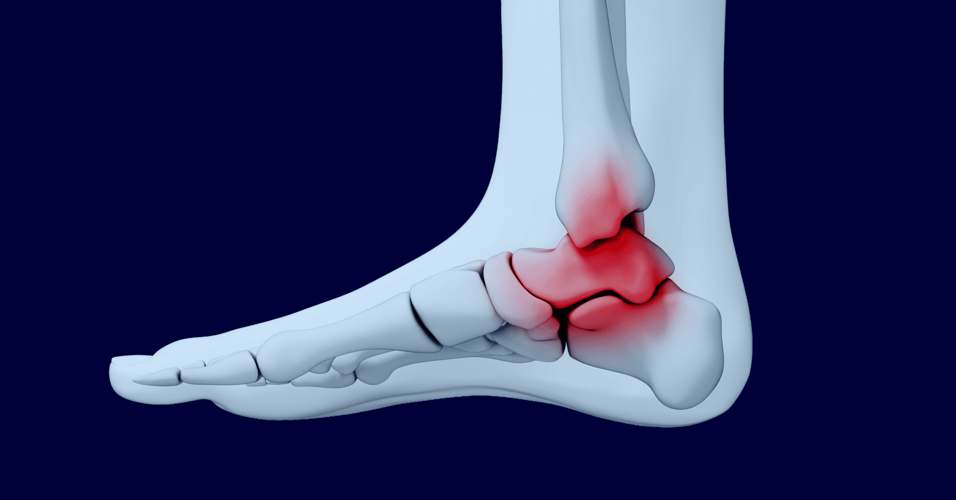 Obrzęk okolicy stawu skokowego u 40-letniego mężczyzny