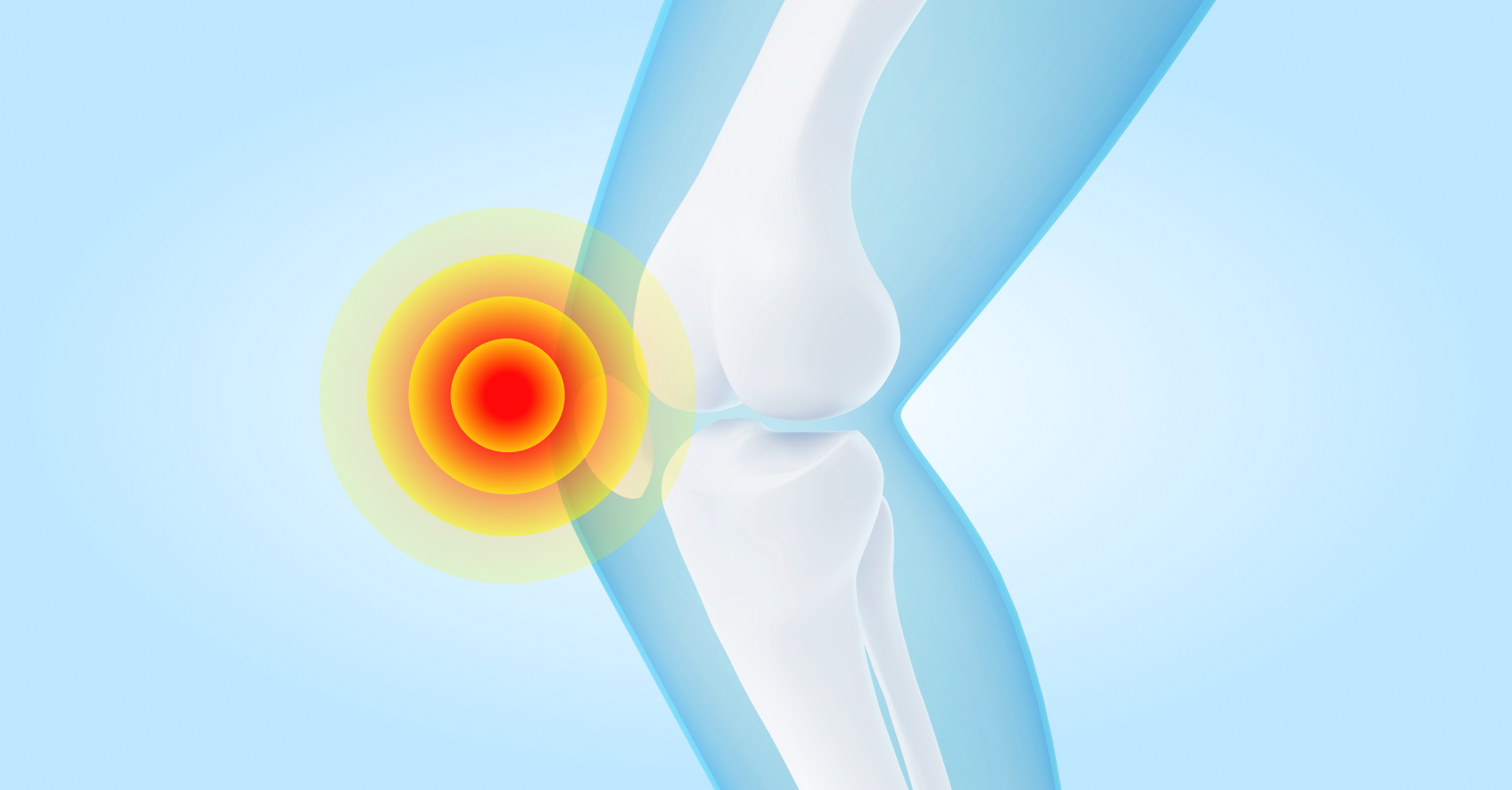 60-letnia pacjentka z bólem kolana i otyłością