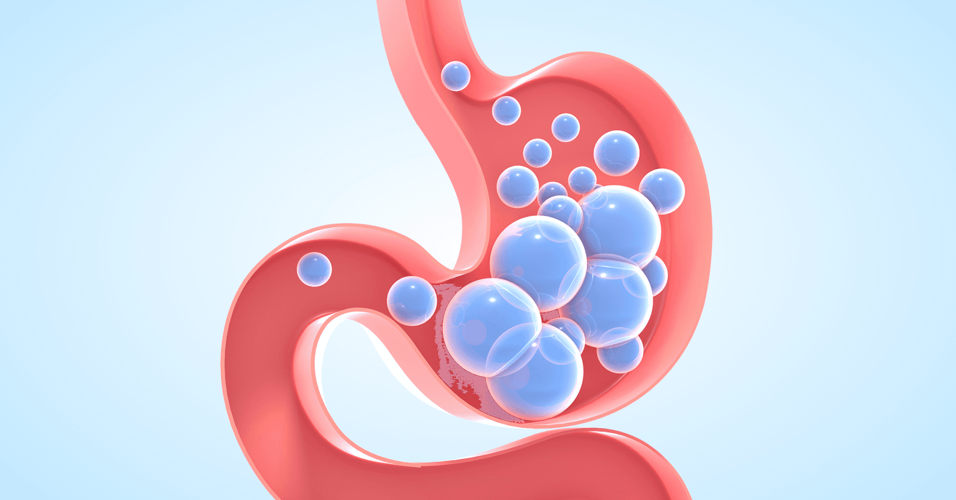 38-letnia pacjentka z nawracającymi wzdęciami, bólem brzucha i uczuciem pełności po posiłkach