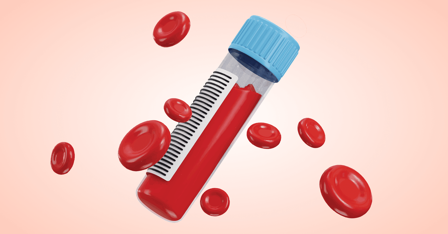 34-letnia pacjentka z nawracającą niedokrwistością