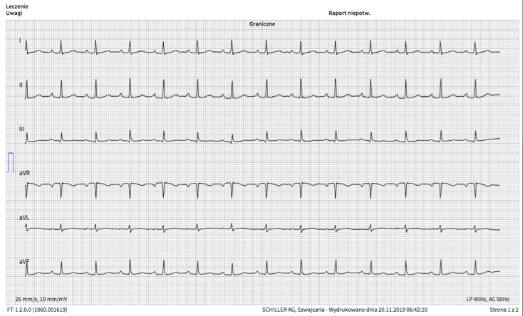 EKG 1