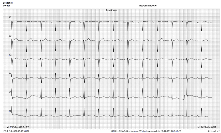 EKG 2