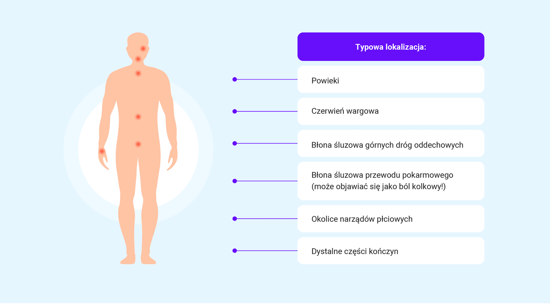 infografika
