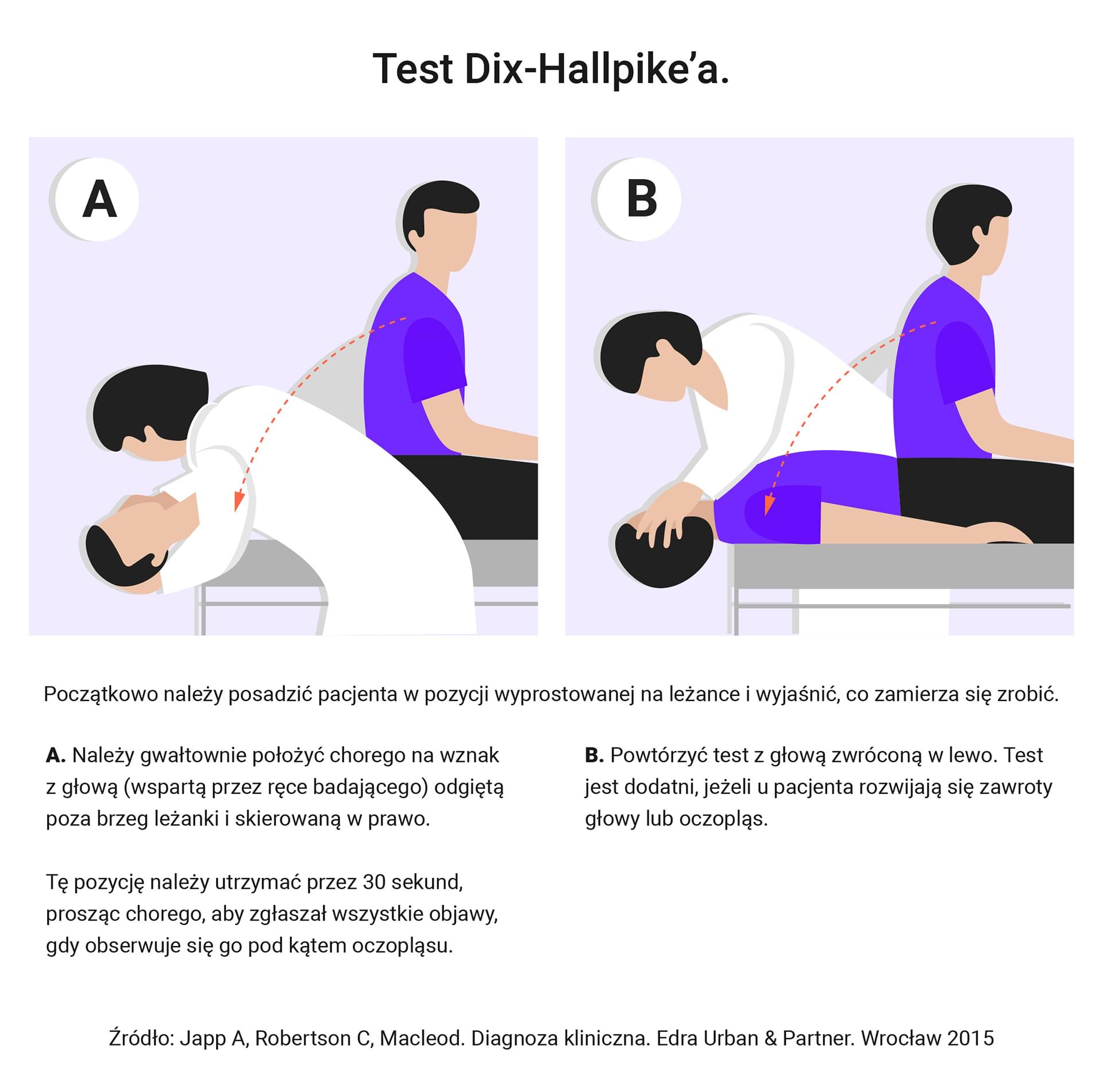 Test Dix-Hallpike'a