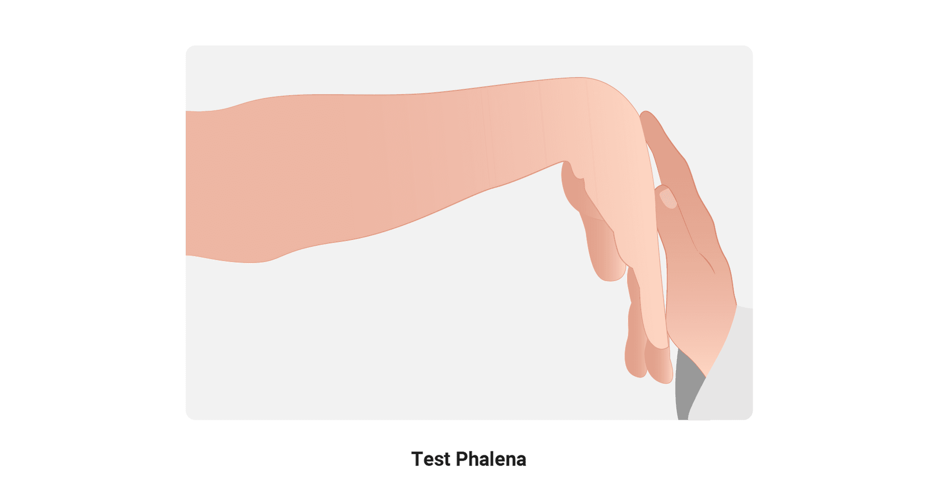 Test Phalena