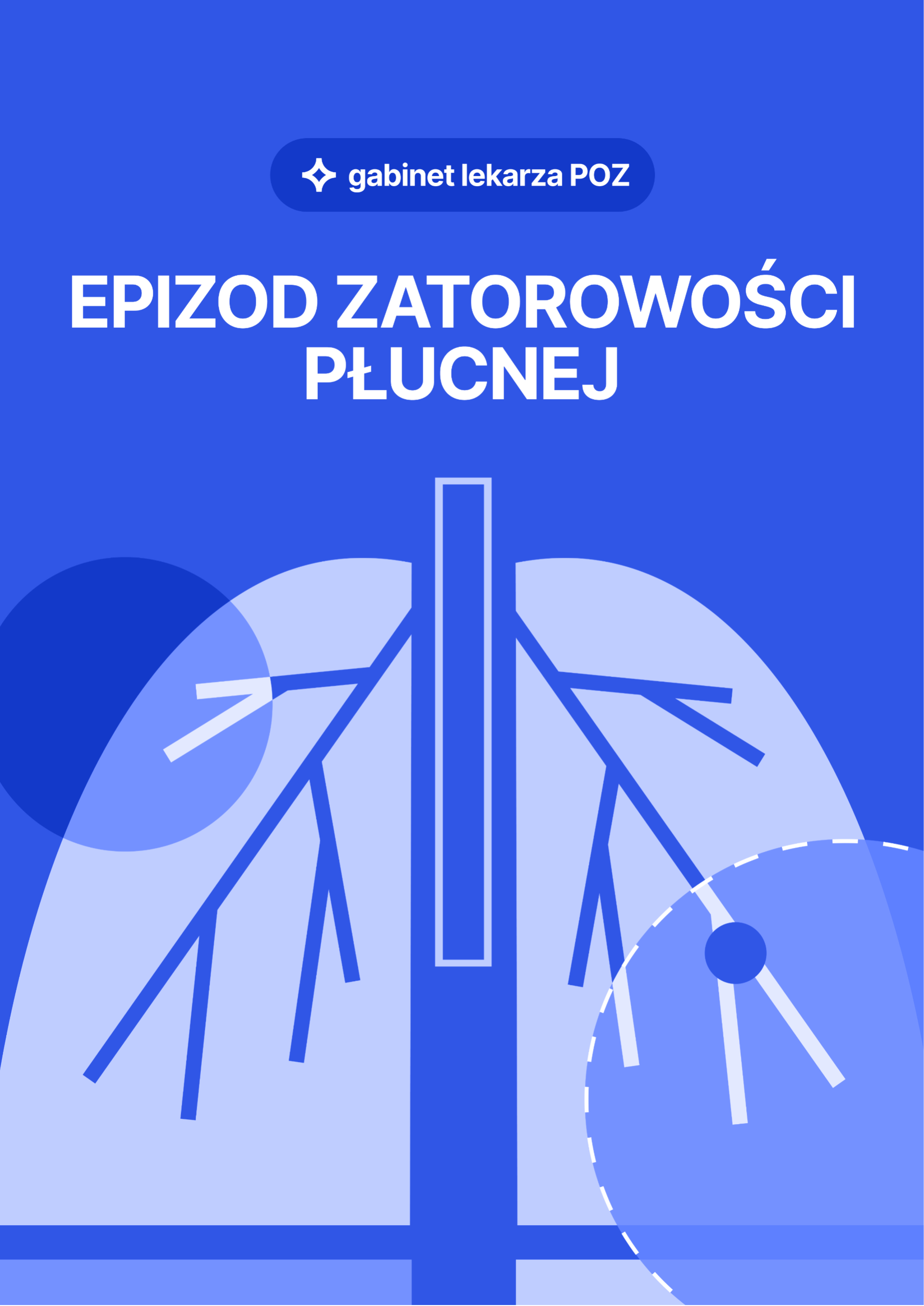 Okładka -- ebook "Pacjent po epizodzie zatorowości  płucnej w POZ"