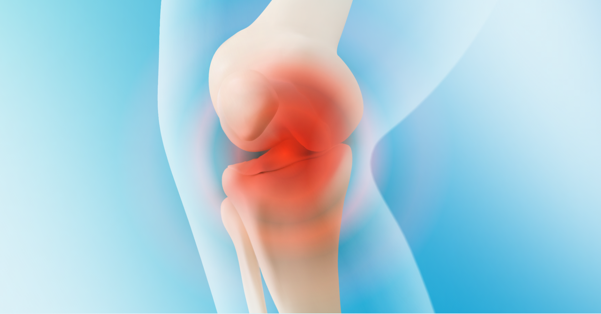 Choroba zwyrodnieniowa stawu kolanowego – praktyczny przewodnik dla lekarzy