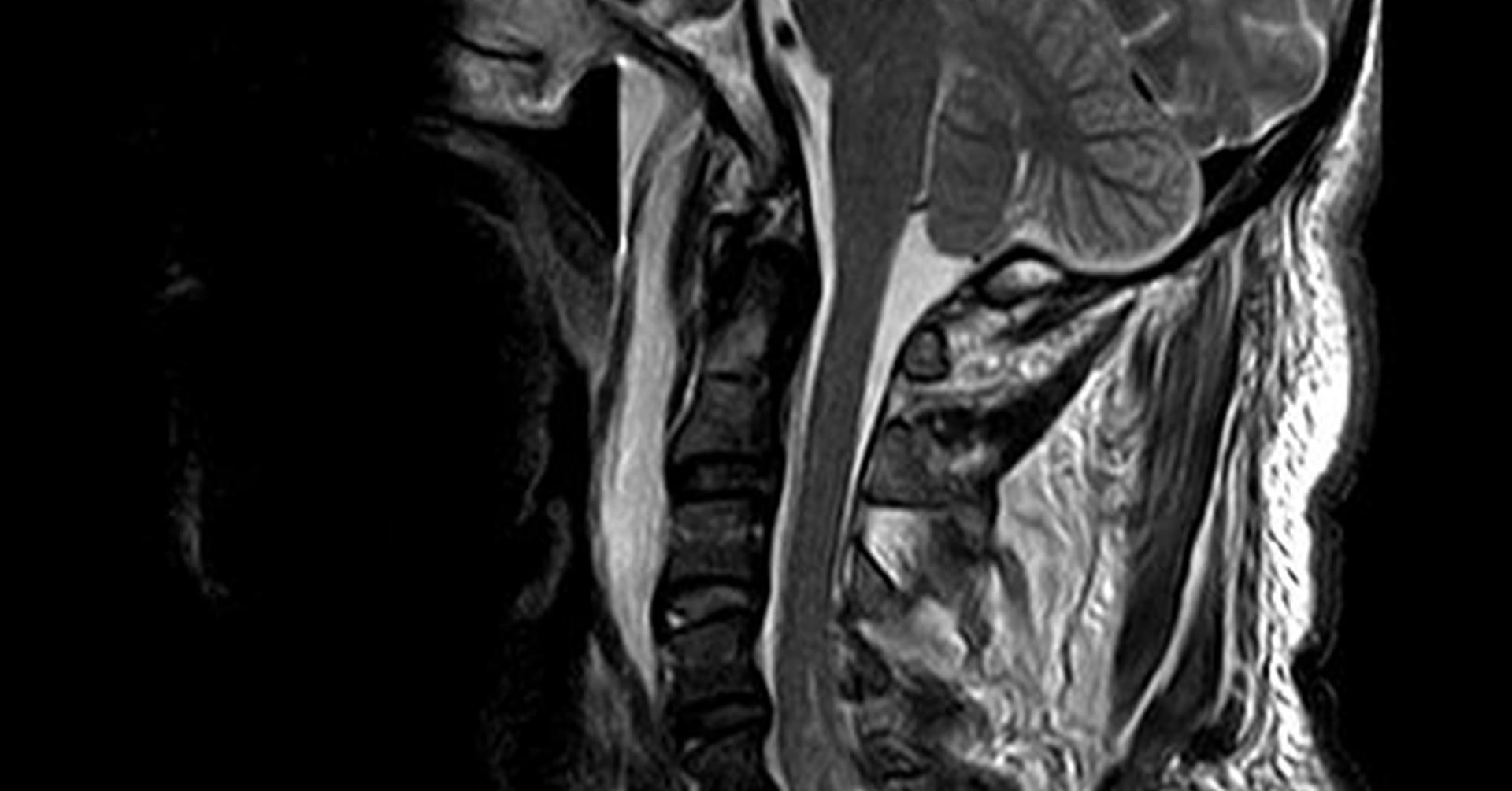 Anatomia radiologiczna głowy i szyi