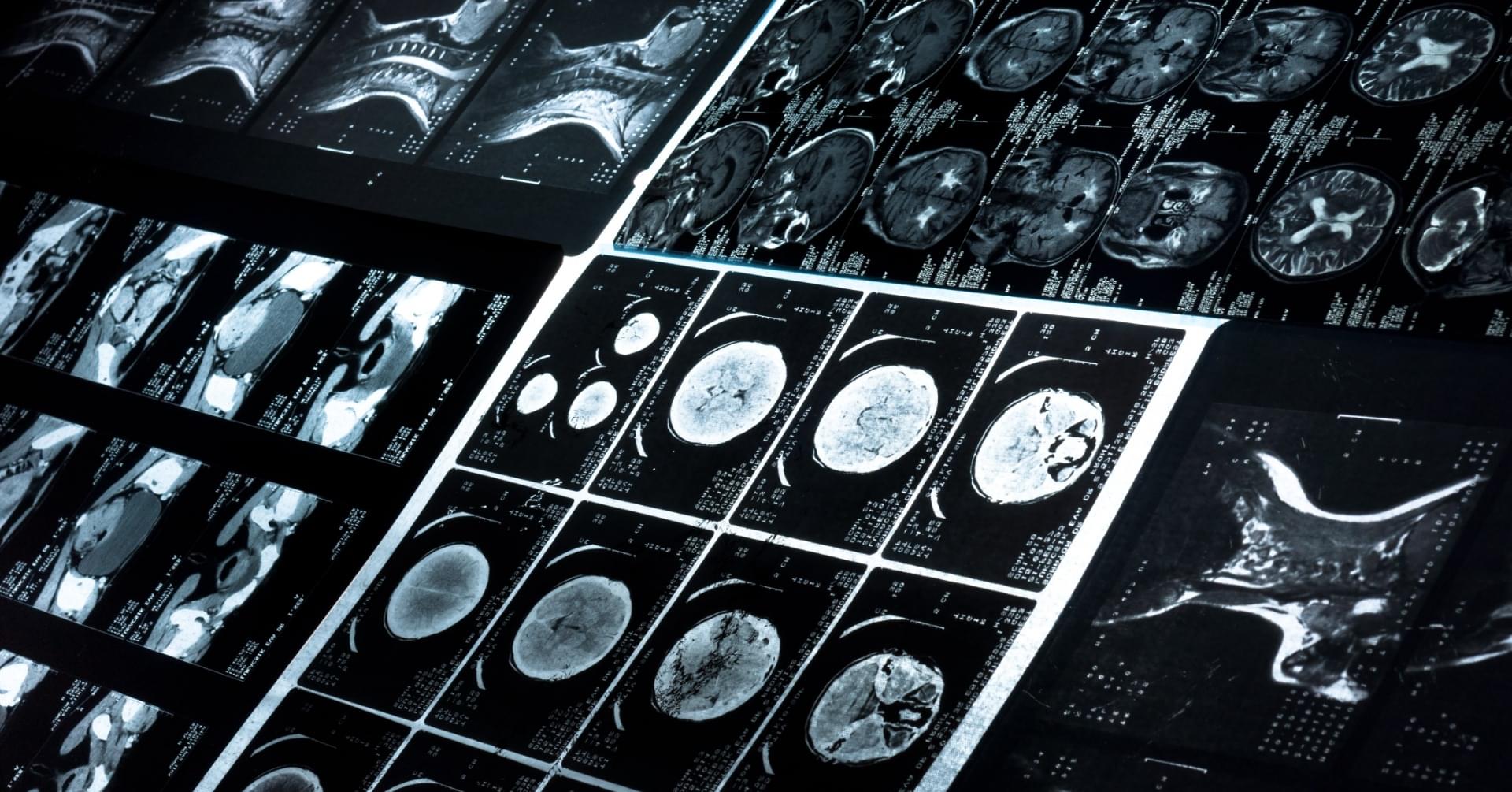 Radiologia na Izbie Przyjęć