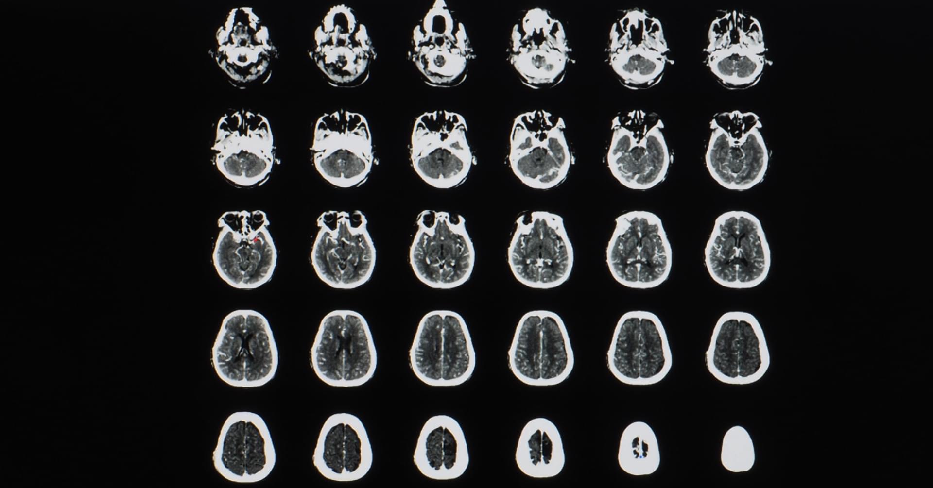 Anatomia radiologiczna mózgu