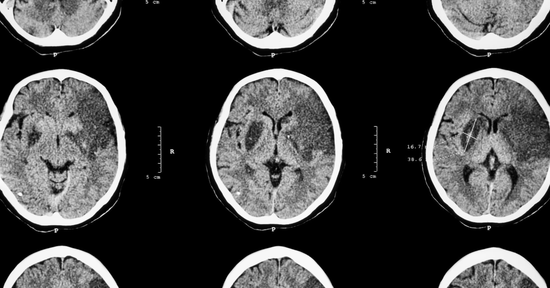 Anatomia radiologiczna mózgu