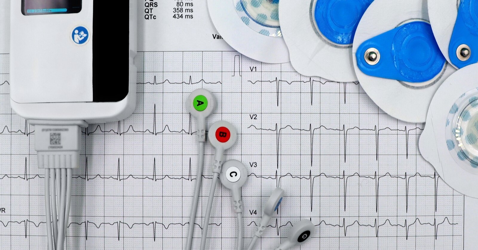 EKG w praktyce lekarza POZ – jak rozpoznać zaburzenia rytmu, które powinny niepokoić?