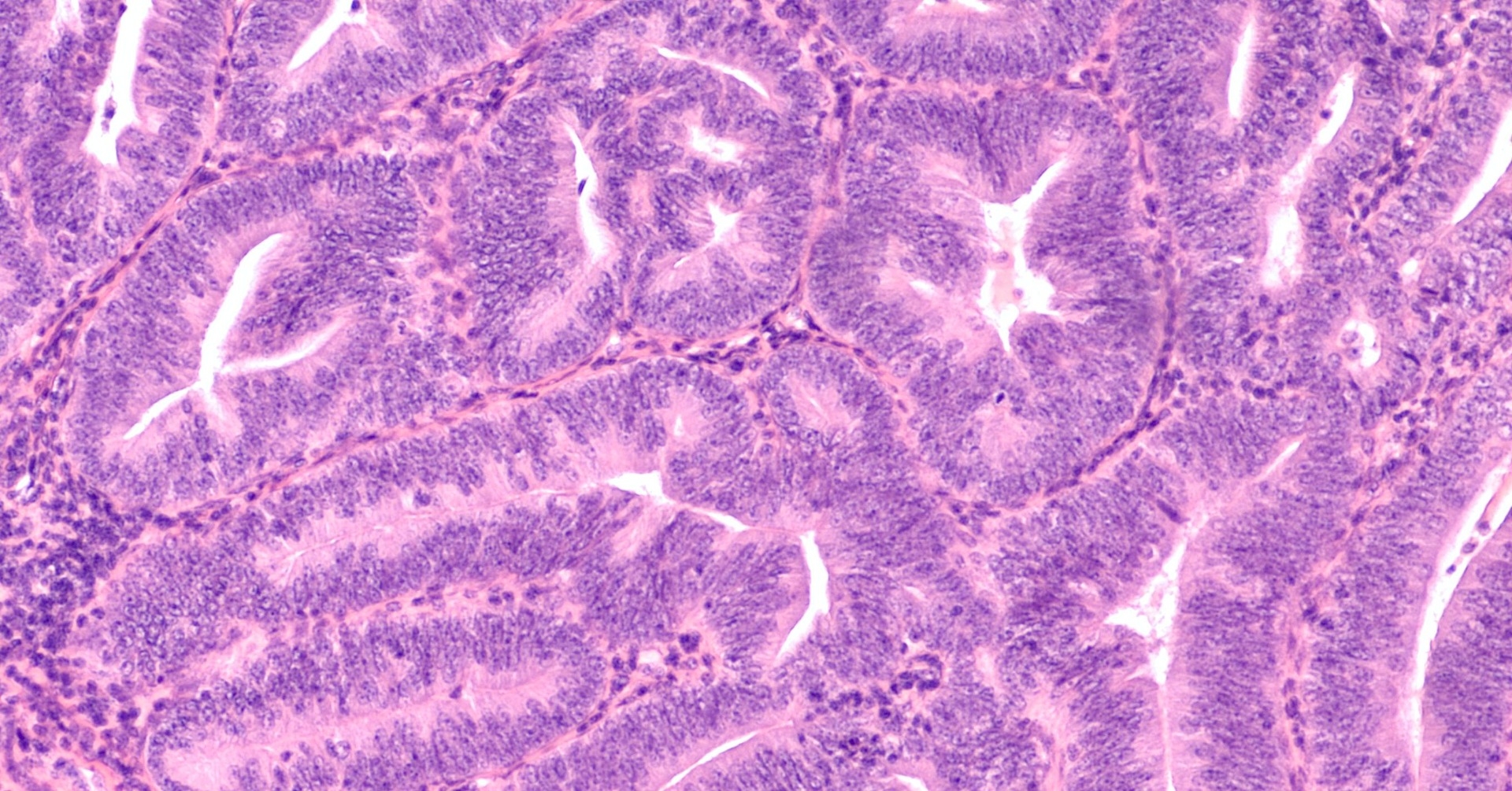 Miejsce patomorfologa w diagnostyce chorób narządu rodnego