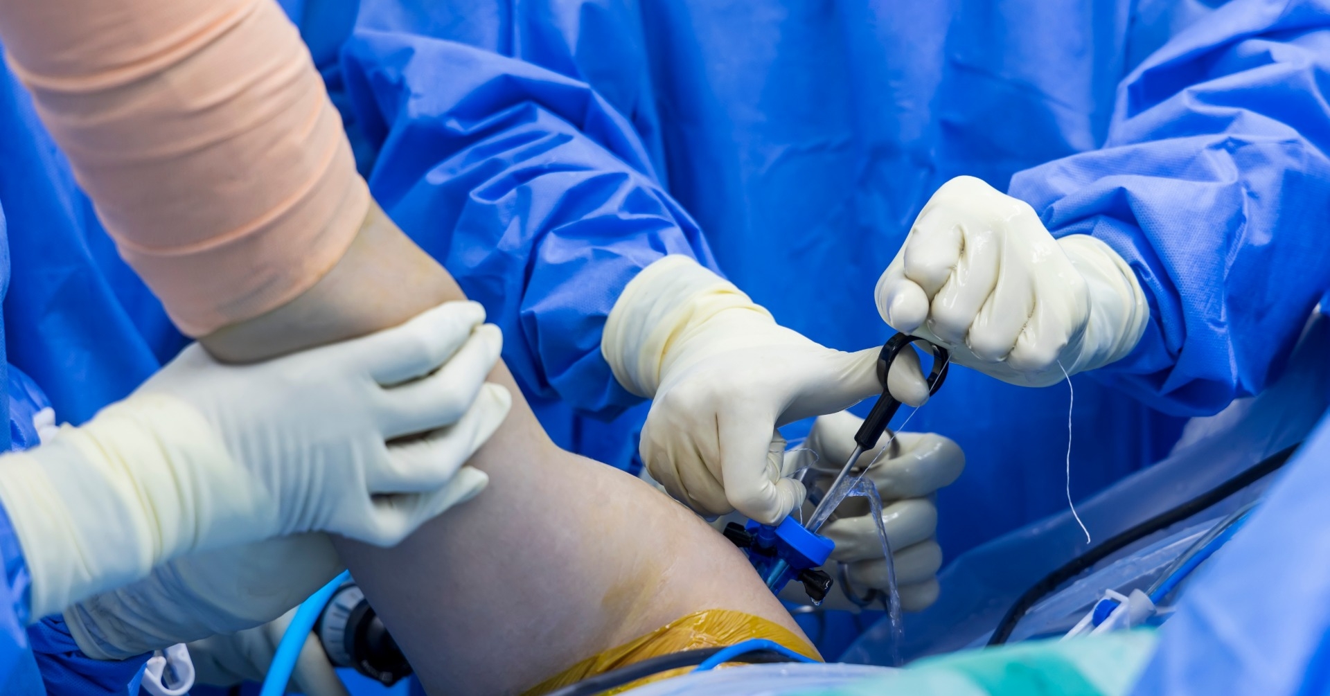 Artroskopia barku – patologie ścięgien stożka rotatorów oraz bicepsa. Kurs kadawerowy