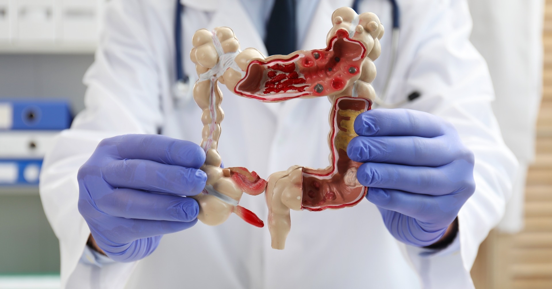 Best Trials, Best Results, Best Journals: Czy wyniki badania BEACON są wciąż znaczące dla pacjentów z mCRC z mut. BRAF V600E?